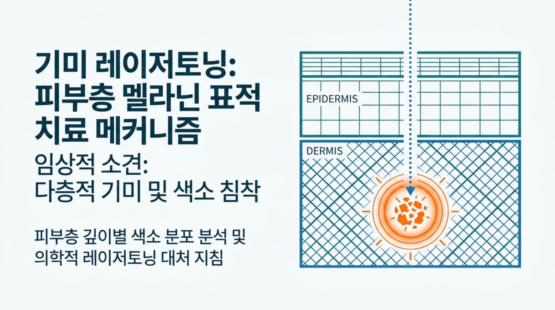 남가좌동 한의원 기미 레이저토닝: 피부층 멜라닌 표적 치료 메커니즘 안내 이미지