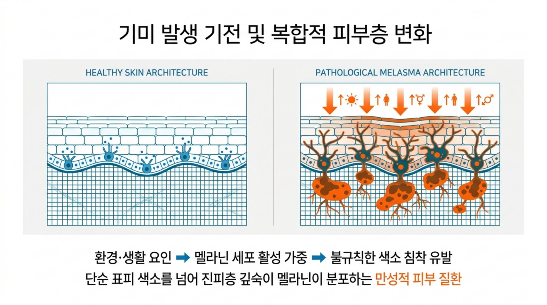 북가좌동 한의원 기미 발생 기전 및 복합적 피부층 변화 안내 이미지