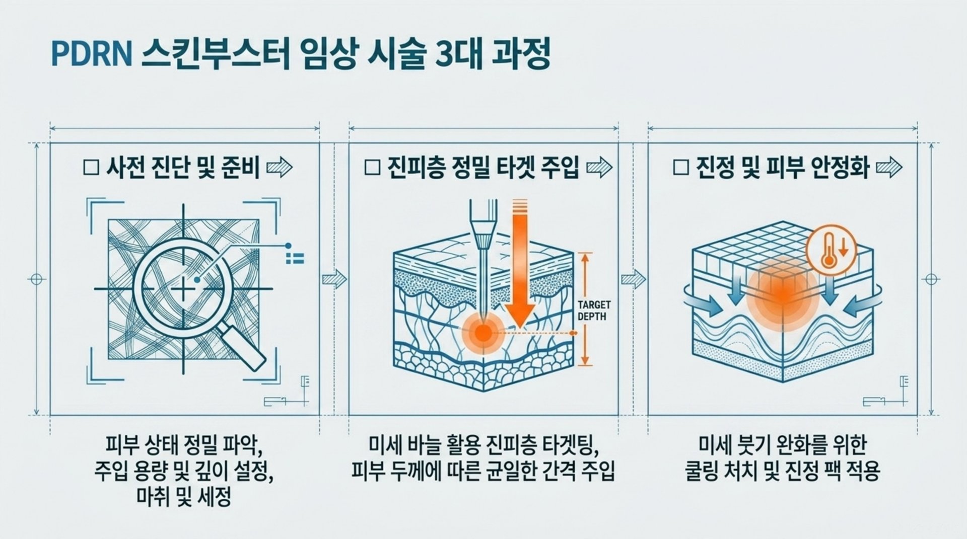 PDRN 스킨부스터 과정 의심 증상 3대 지표