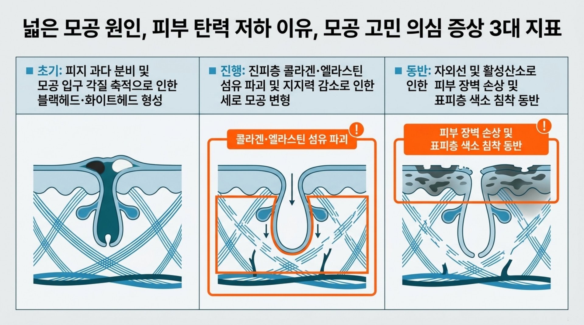 남가좌동 한의원 넓은 모공 원인, 피부 탄력 저하 이유, 모공 고민 의심 증상 3대 지표 안내 이미지