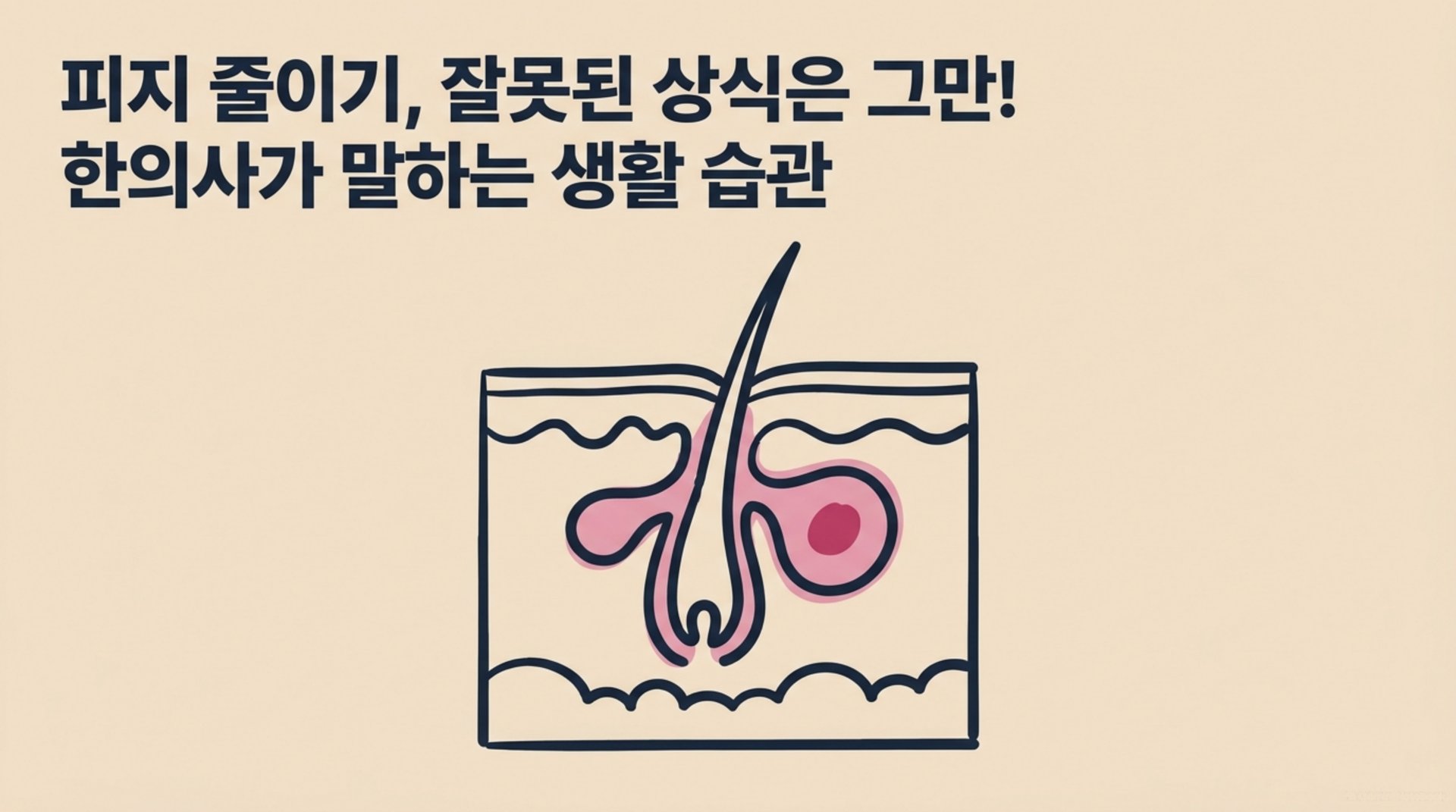 남가좌동 한의원 피지 줄이기, 잘못된 상식은 그만! 한의사가 말하는 생활 습관 안내 이미지
