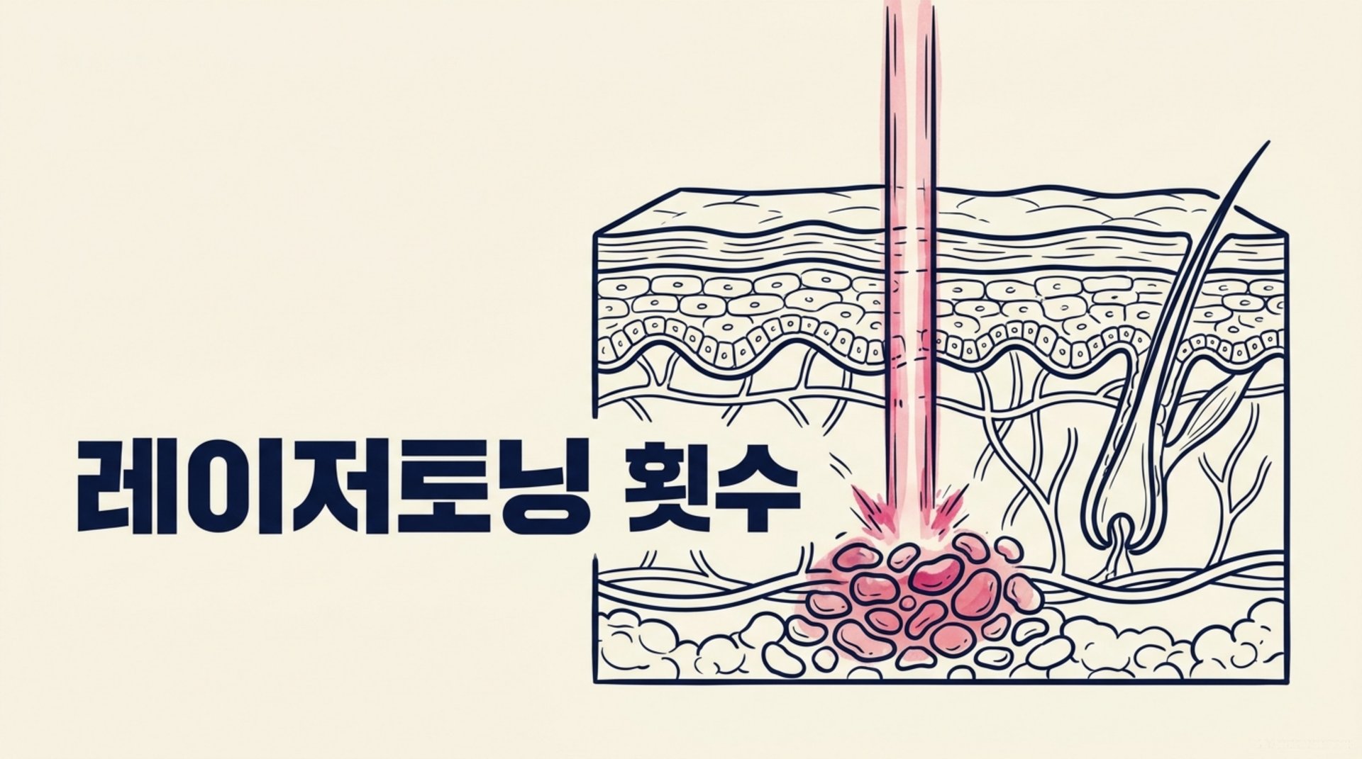 남가좌동 한의원 레이저토닝 횟수 안내 이미지