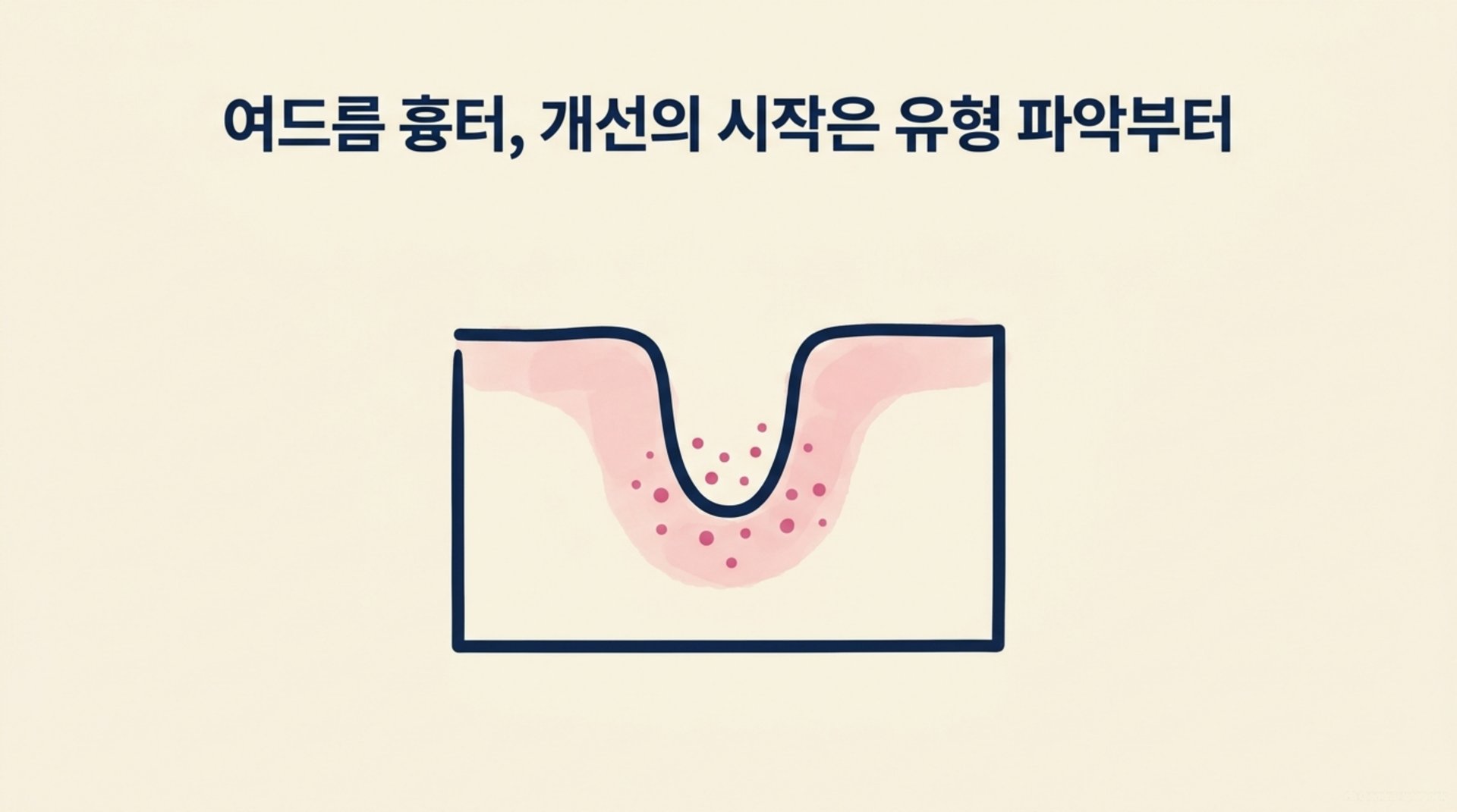 남가좌동 한의원 여드름 흉터, 개선의 시작은 유형 파악부터 안내 이미지