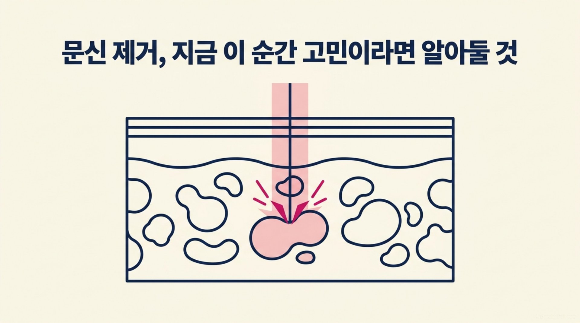 남가좌동 한의원 문신 제거, 지금 이 순간 고민이라면 알아둘 것 안내 이미지