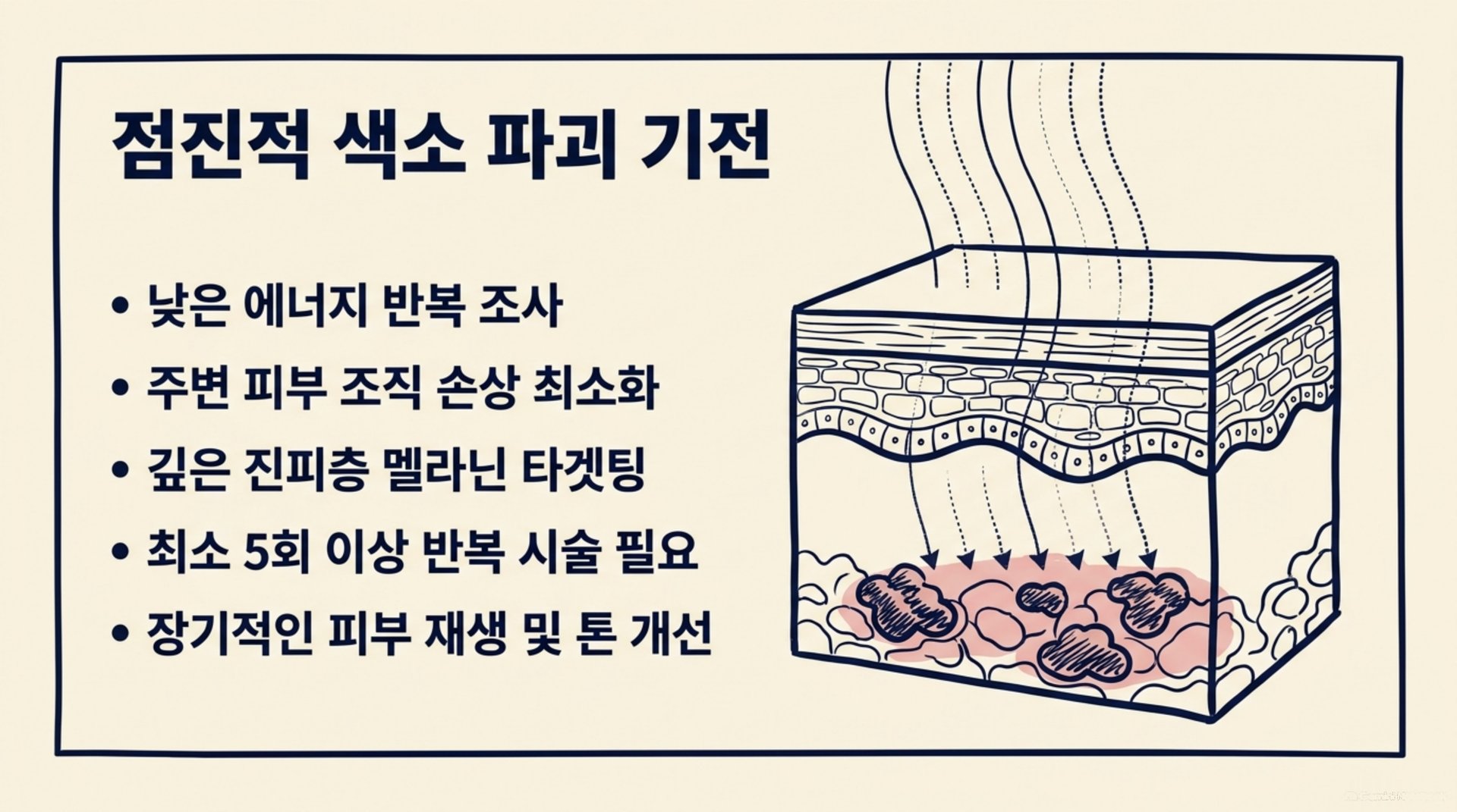 북가좌동 한의원 점진적 색소 파괴 기전 안내 이미지