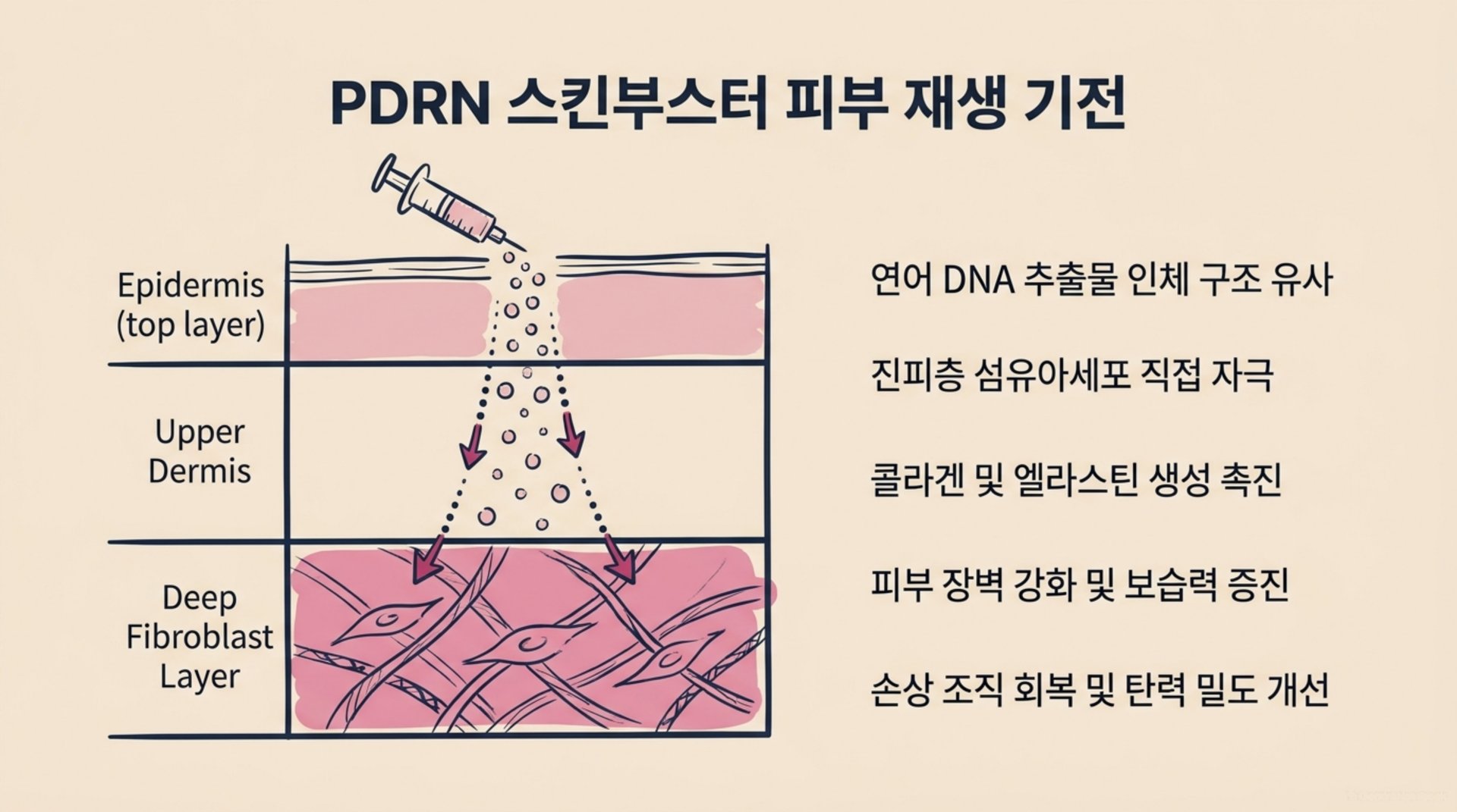 북가좌동 한의원 PDRN 스킨부스터 피부 재생 기전 안내 이미지