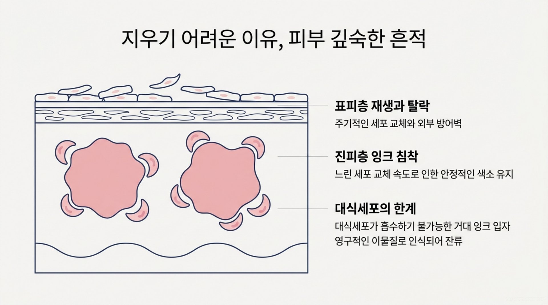 북가좌동 한의원 지우기 어려운 이유, 피부 깊숙한 흔적 안내 이미지