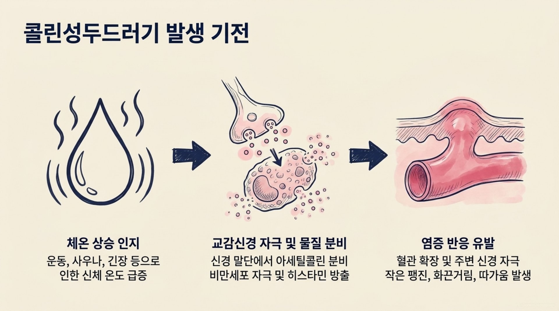 서대문구 한의원 콜린성두드러기 발생 기전 안내 이미지