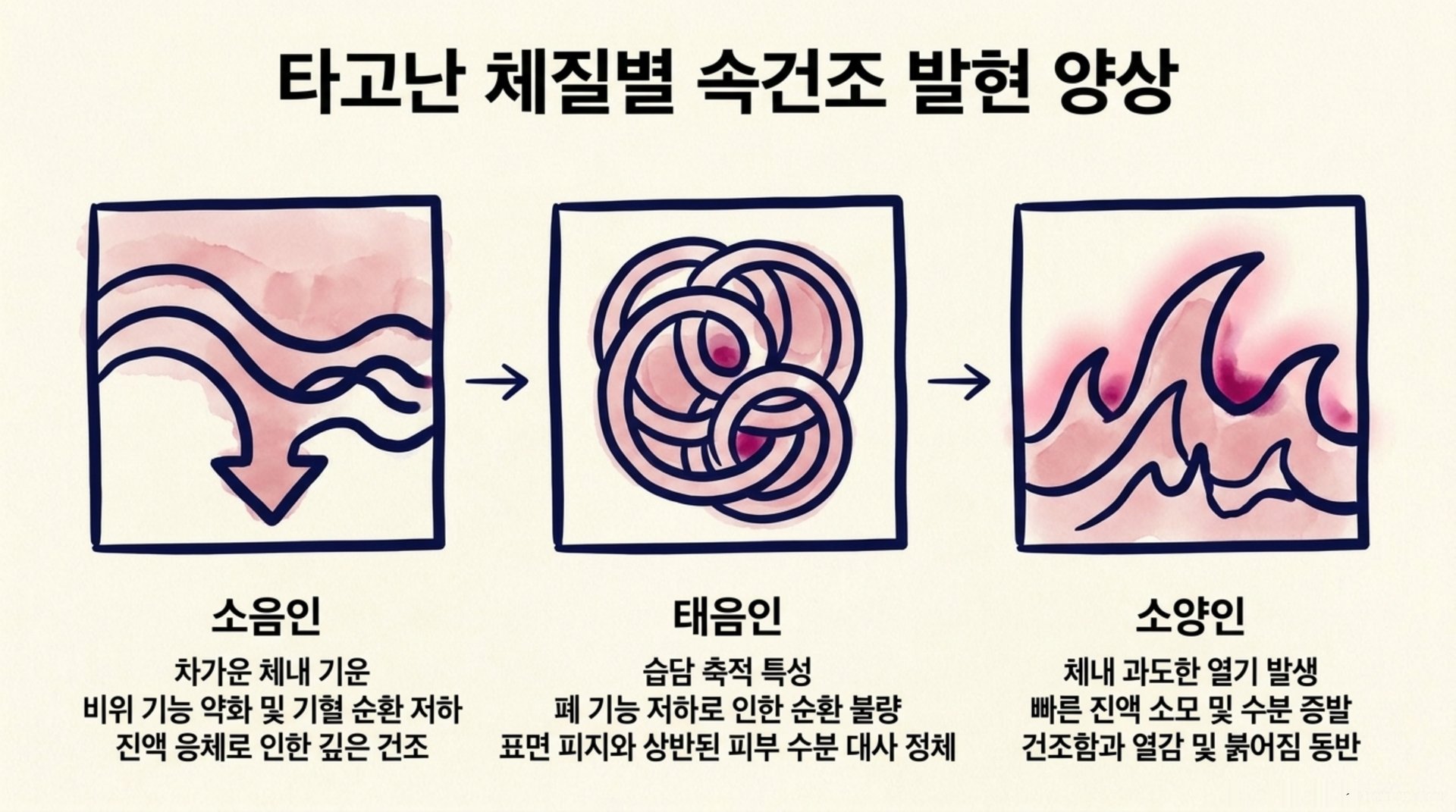 남가좌동 한의원 타고난 체질별 속건조 발현 양상 안내 이미지