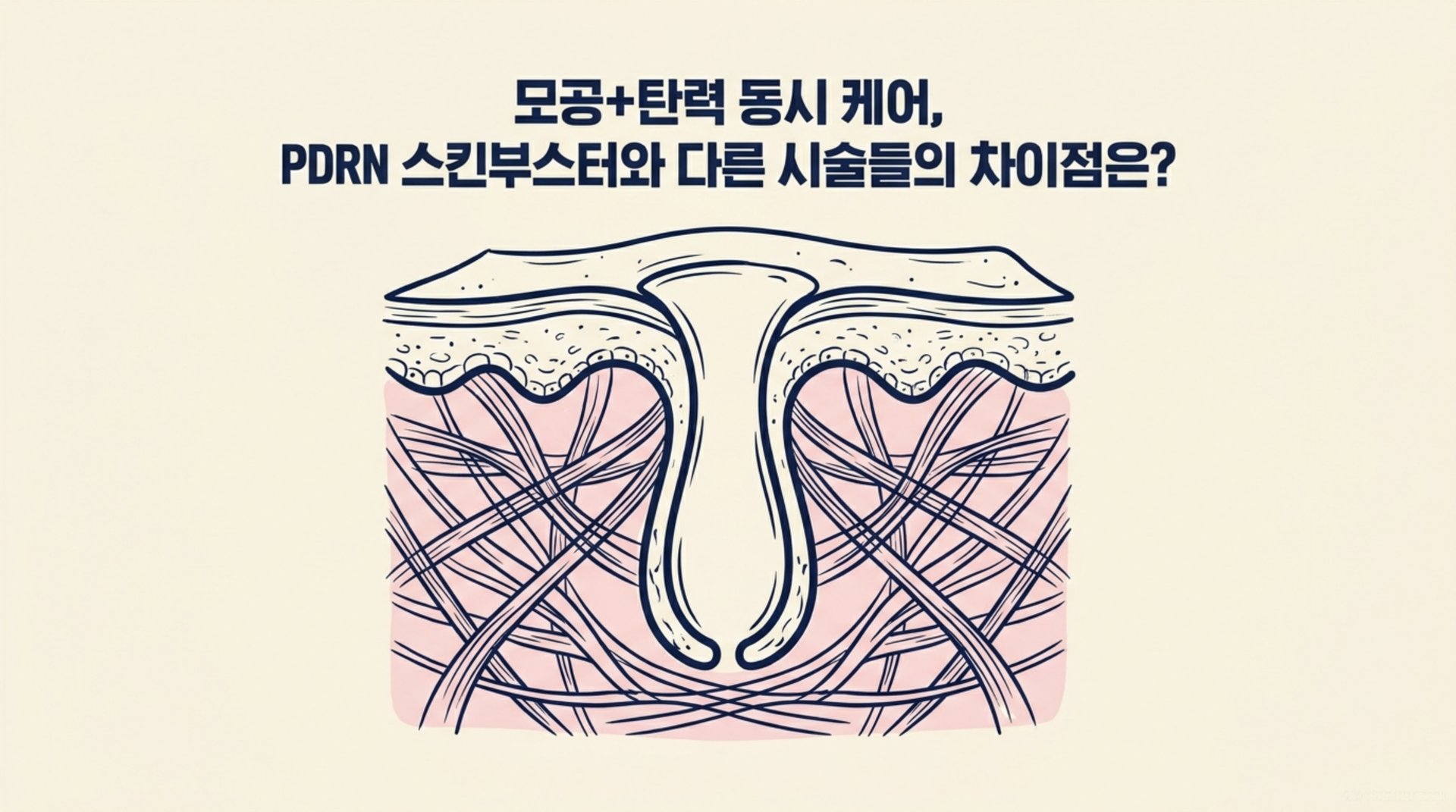 남가좌동 한의원 모공+탄력 동시 케어, PDRN 스킨부스터와 다른 시술들의 차이점은? 안내 이미지