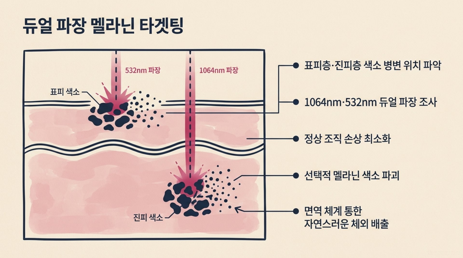 북가좌동 한의원 듀얼 파장 멜라닌 타겟팅 안내 이미지