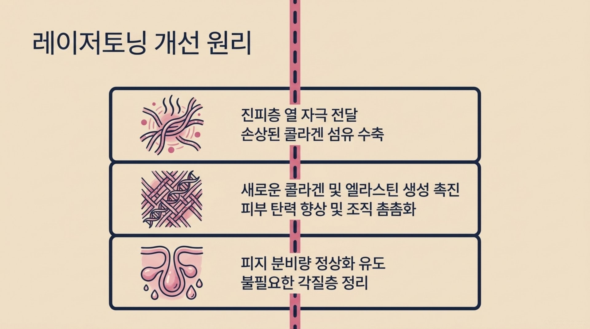 서대문구 한의원 레이저토닝 개선 원리 안내 이미지