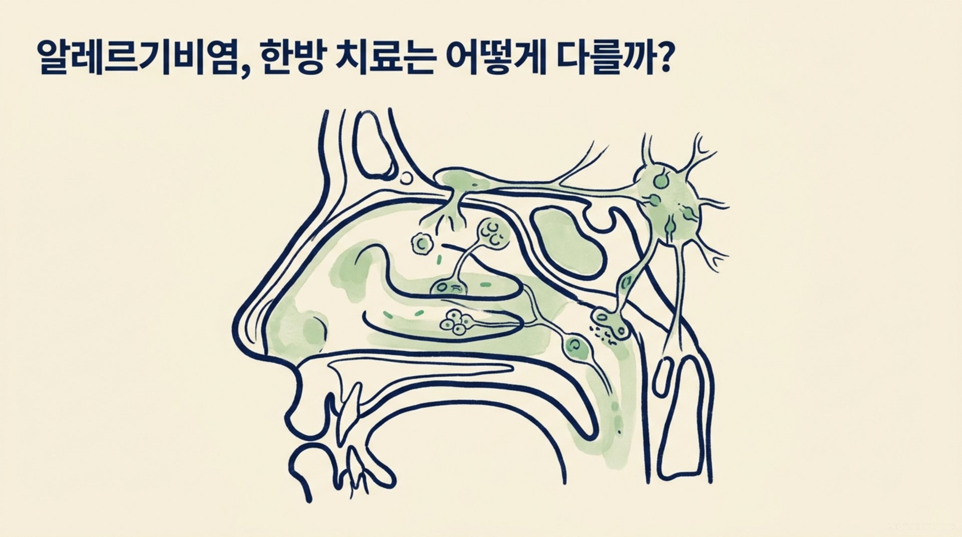 남가좌동 한의원 알레르기비염, 한방 치료는 어떻게 다를까? 안내 이미지