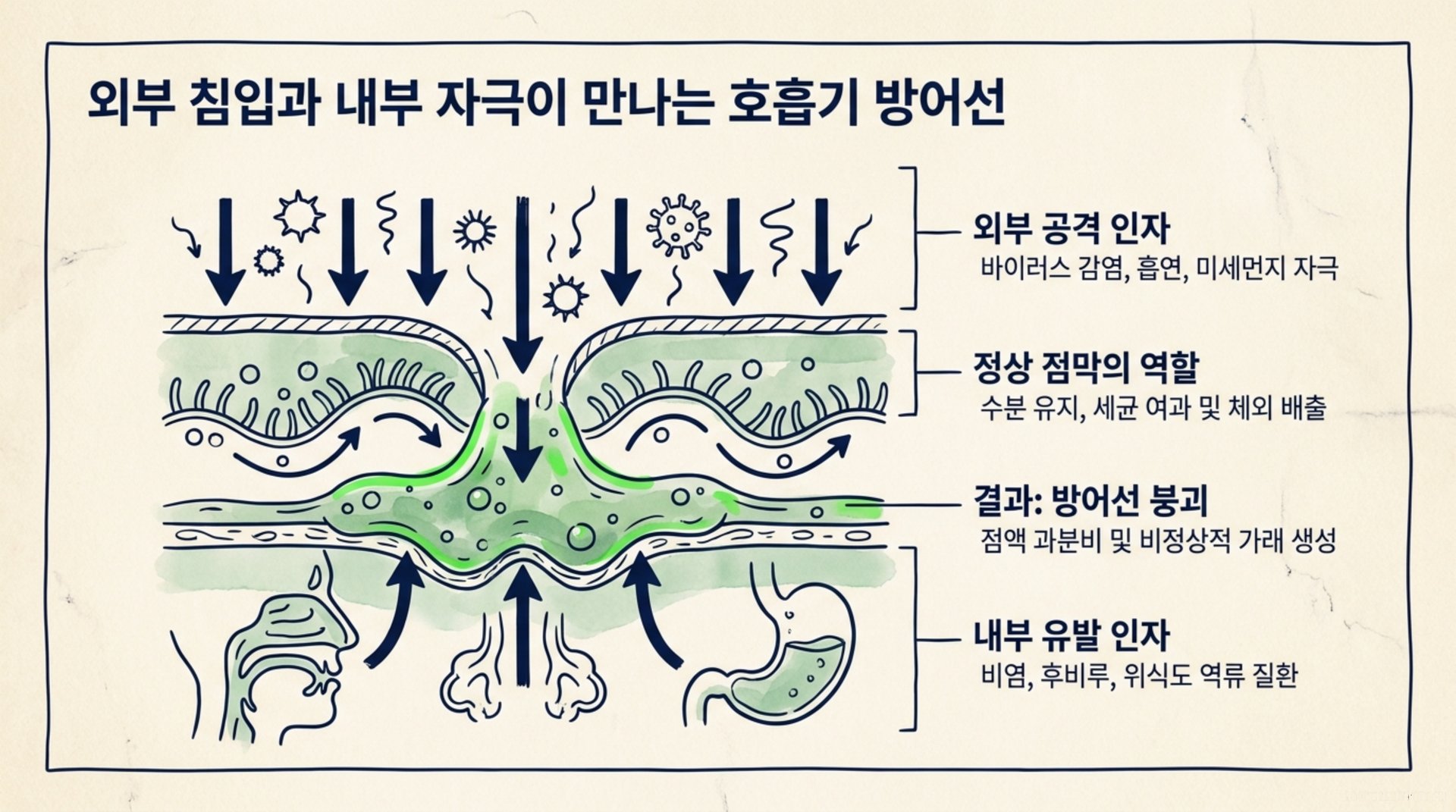 북가좌동 한의원 외부 침입과 내부 자극이 만나는 호흡기 방어선 안내 이미지