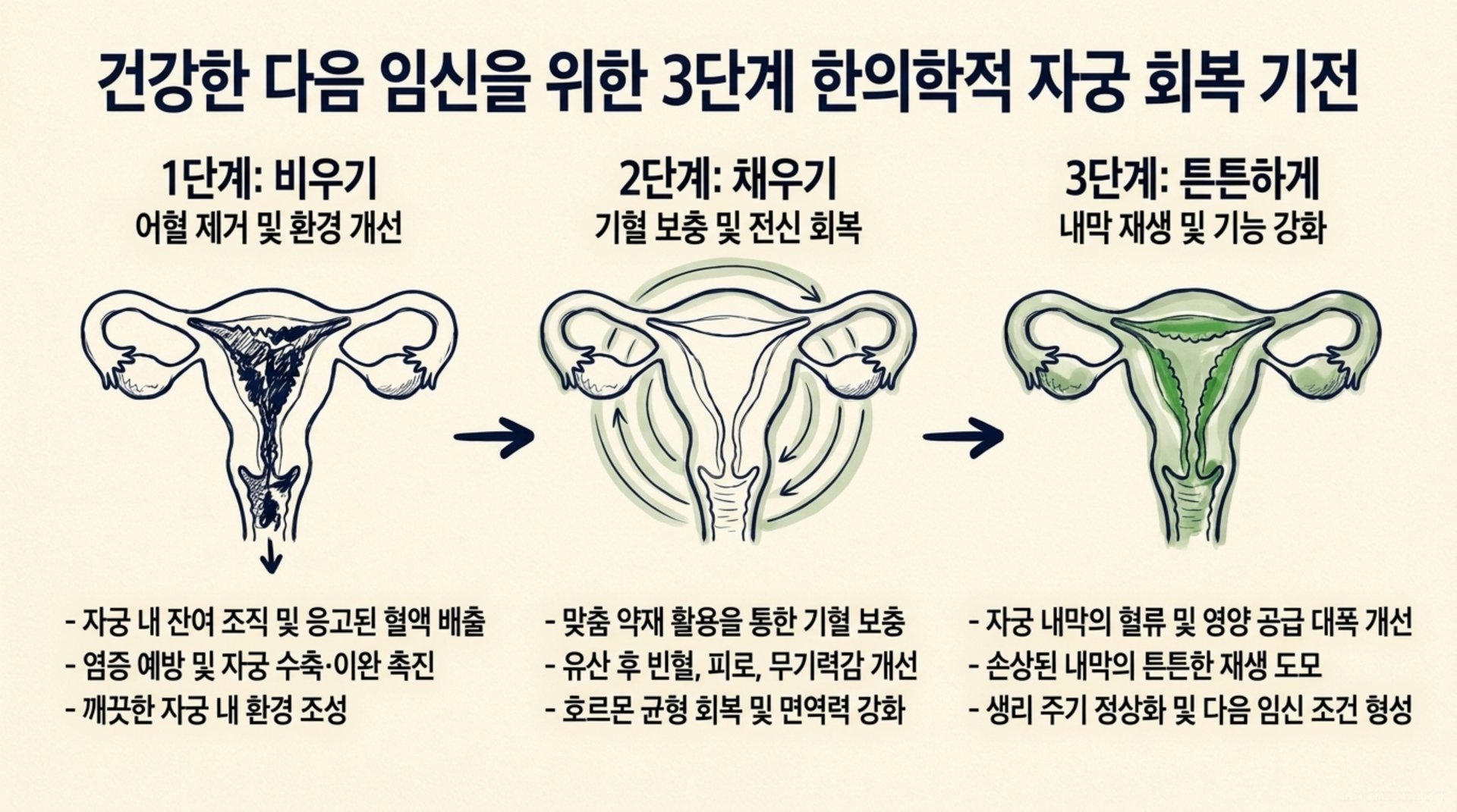 서대문구 한의원 건강한 다음 임신을 위한 3단계 한의학적 자궁 회복 기전 안내 이미지