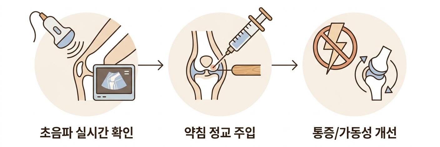 초음파 유도하 약침 요법의 시술 과정 및 효과, 가좌역한방치료한의원 | 초음파 실시간 확인 · 약침 정교 주입 · 통증/가동성 개선
