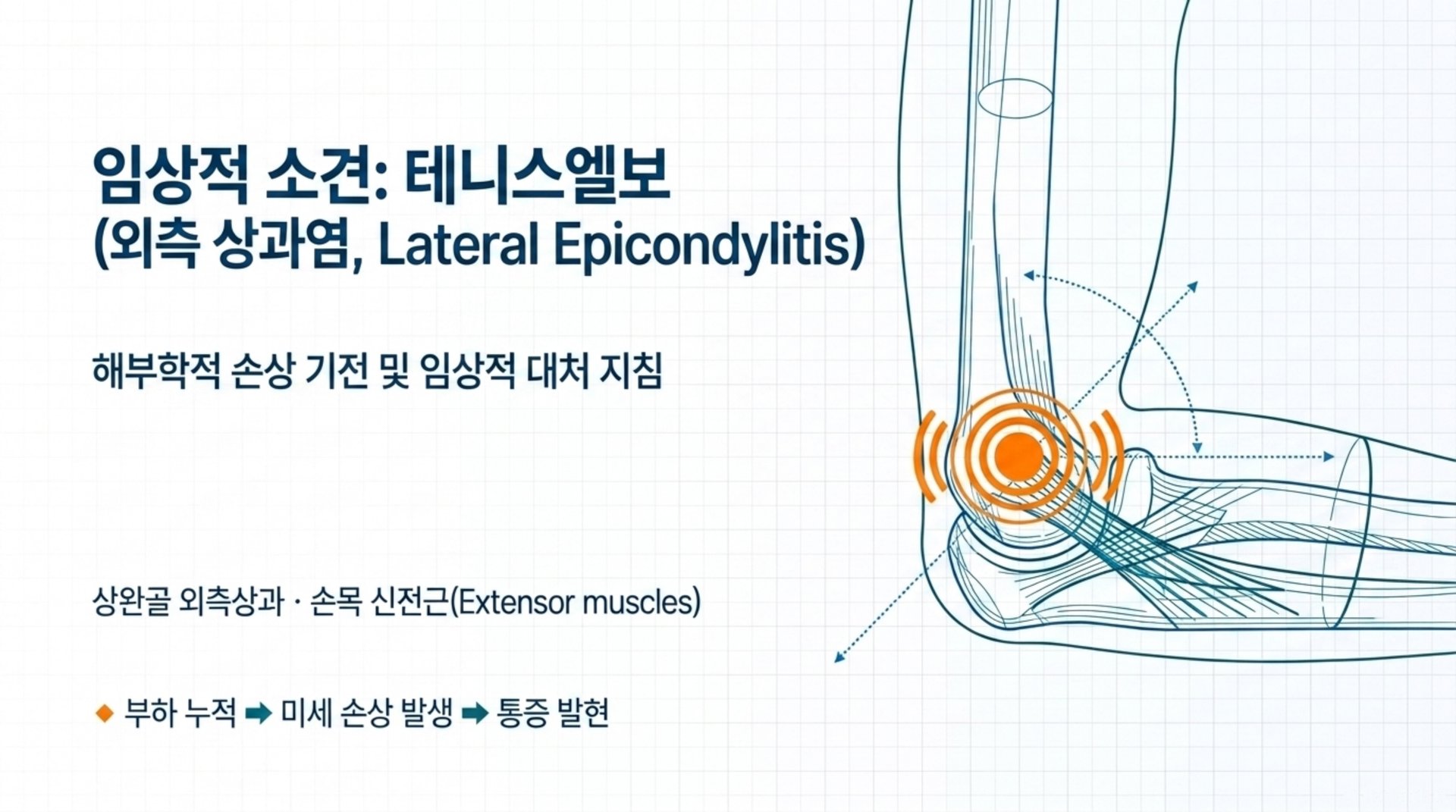 임상적 소견: 테니스엘보