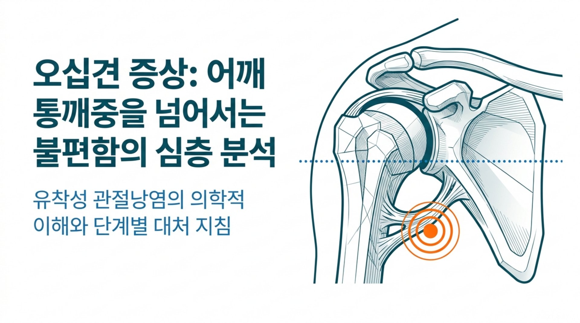 남가좌동 한의원 오십견 증상: 어깨 통증을 넘어서는 불편함의 심층 분석 안내 이미지