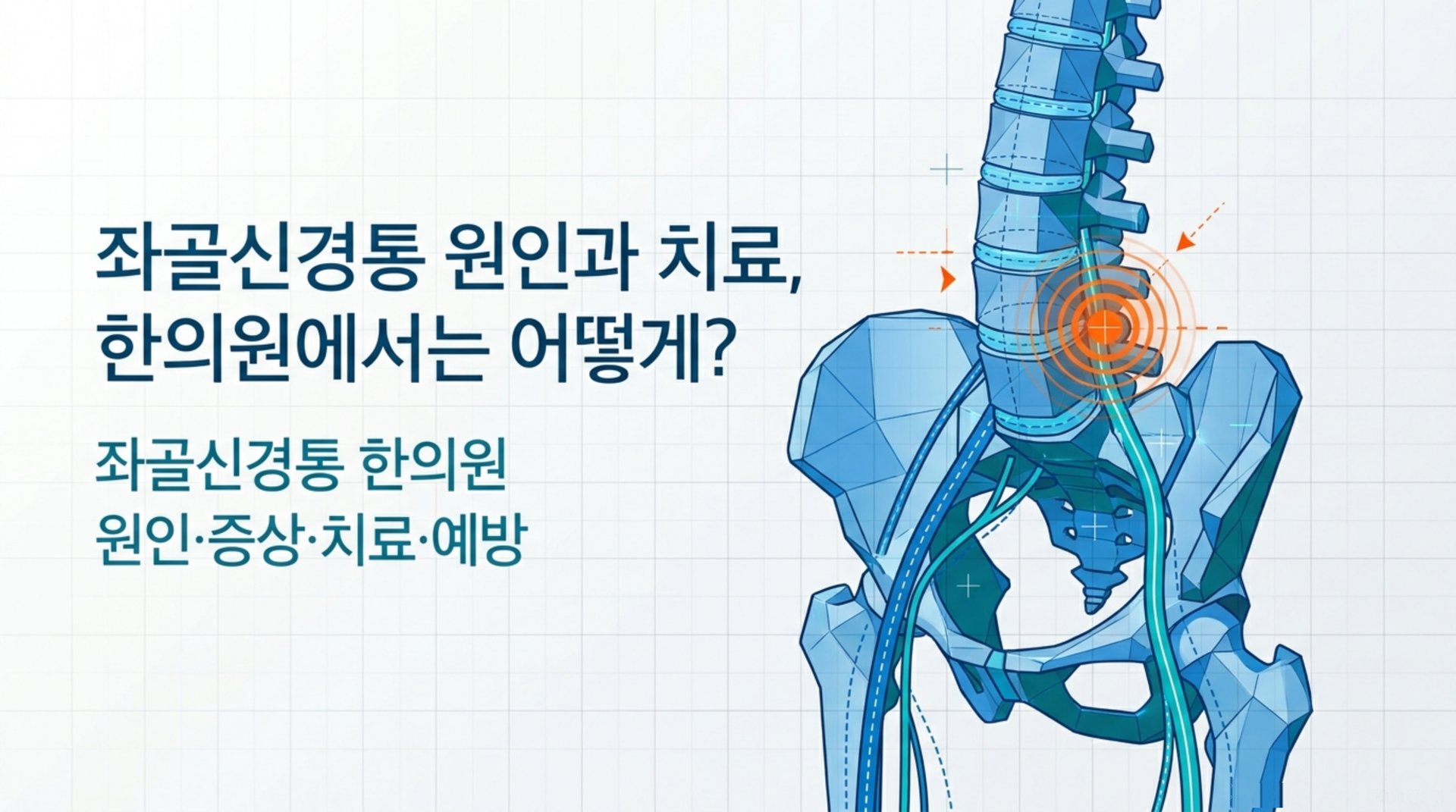 남가좌동 한의원 좌골신경통 원인과 치료, 한의원에서는 어떻게? 안내 이미지