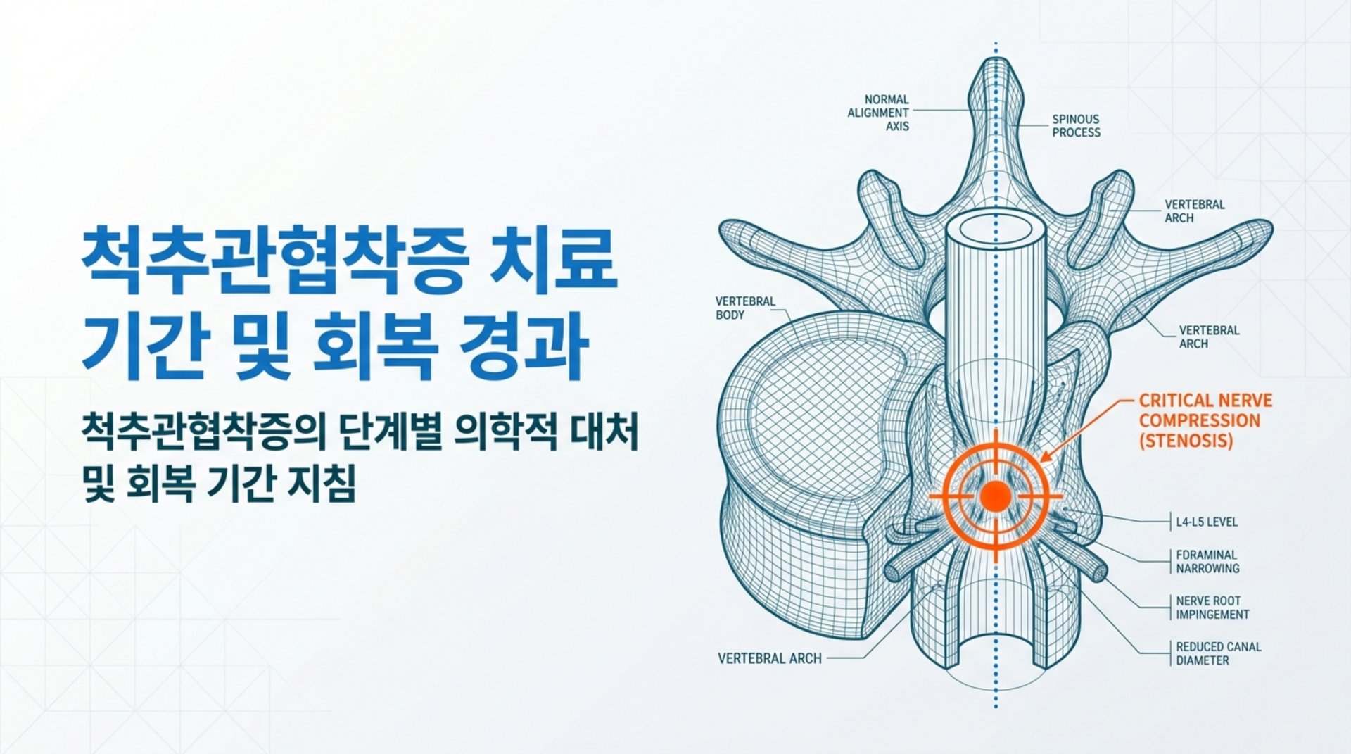 남가좌동 한의원 척추관협착증 치료 기간 및 회복 경과 안내 이미지