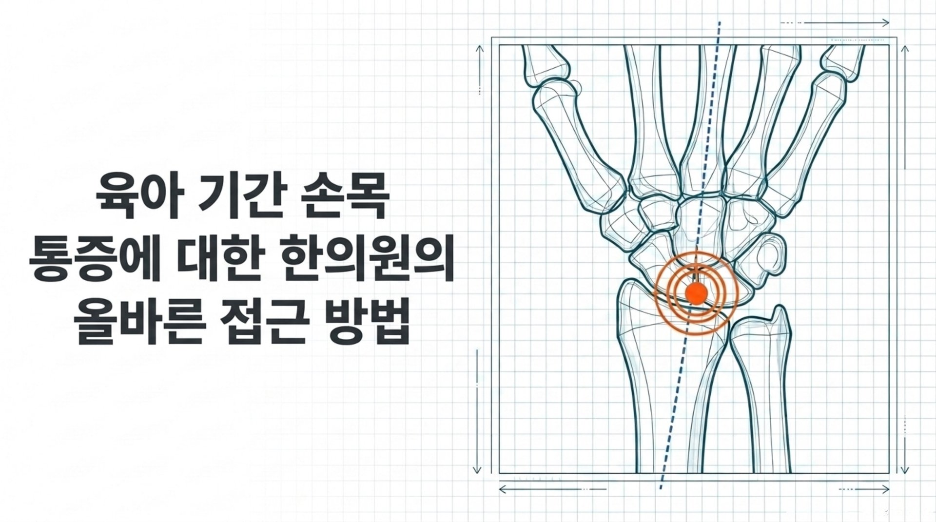 남가좌동 한의원 임상적 소견: 육아 손목 한의원 안내 이미지
