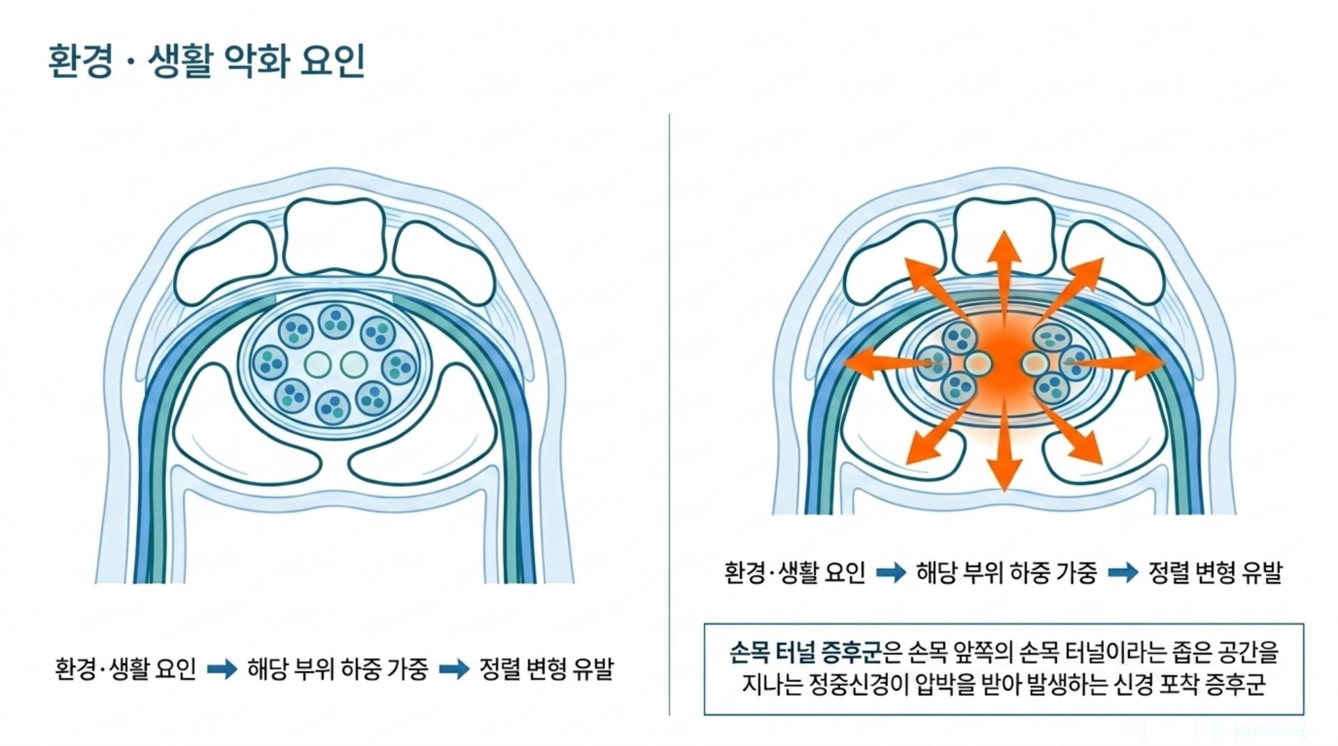 북가좌동 한의원 현대인과 해당 부위 건강 안내 이미지
