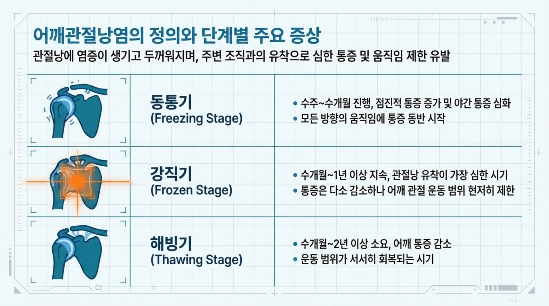 서대문구 한의원 어깨관절낭염의 정의와 단계별 주요 증상 안내 이미지
