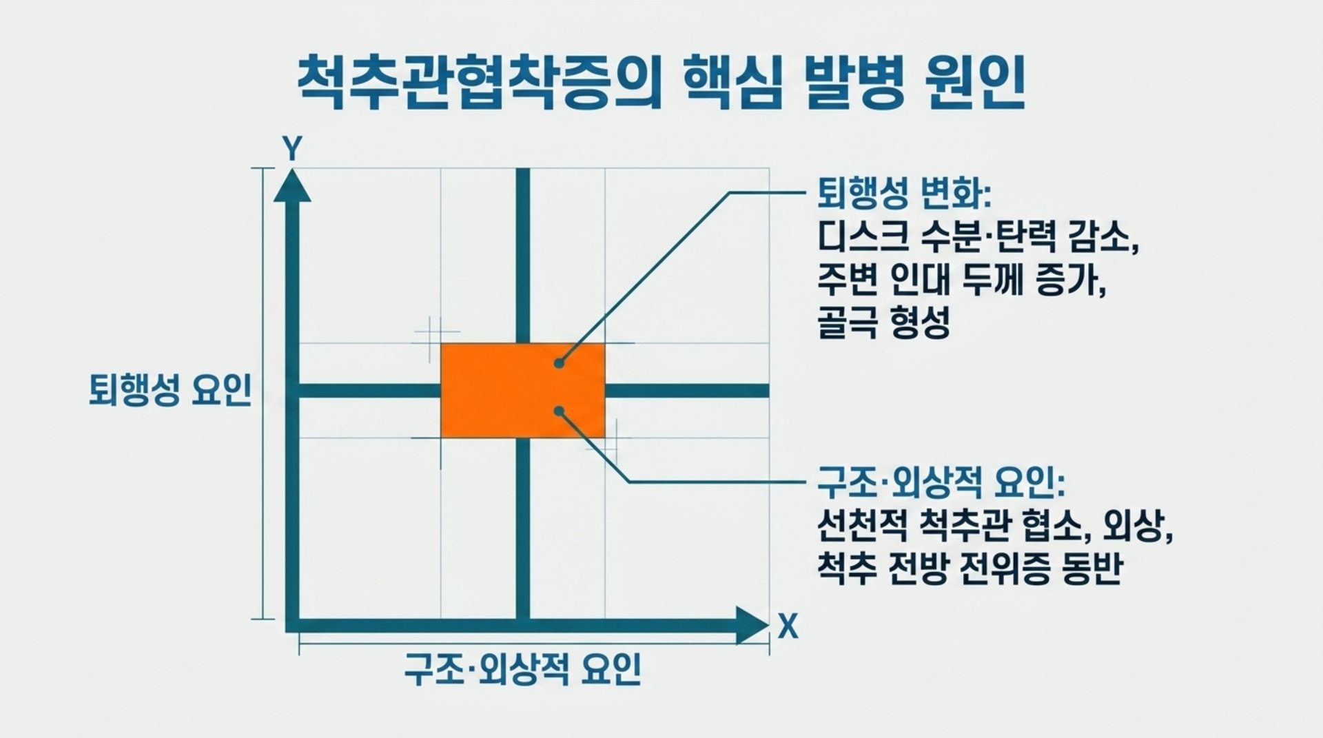 서대문구 한의원 척추관협착증의 핵심 발병 원인 안내 이미지