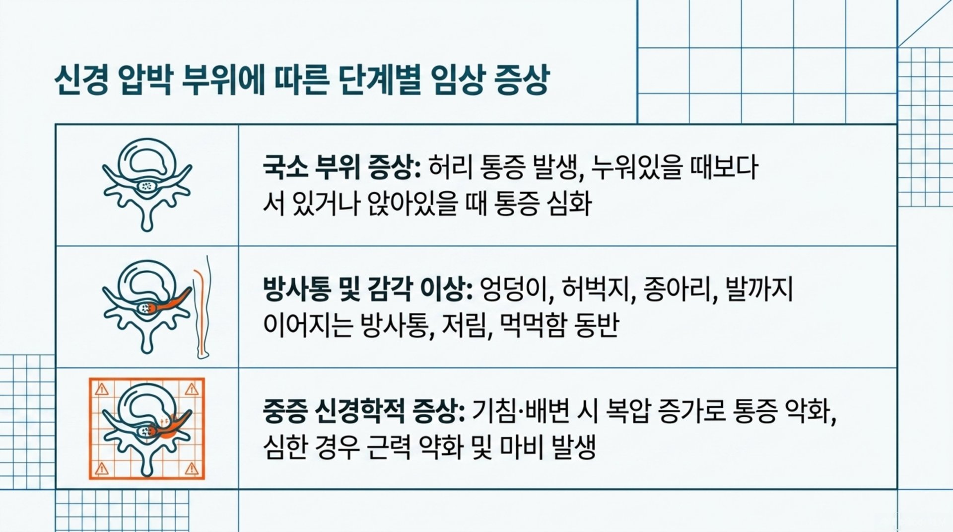 남가좌동 한의원 신경 압박 부위에 따른 단계별 임상 증상 안내 이미지