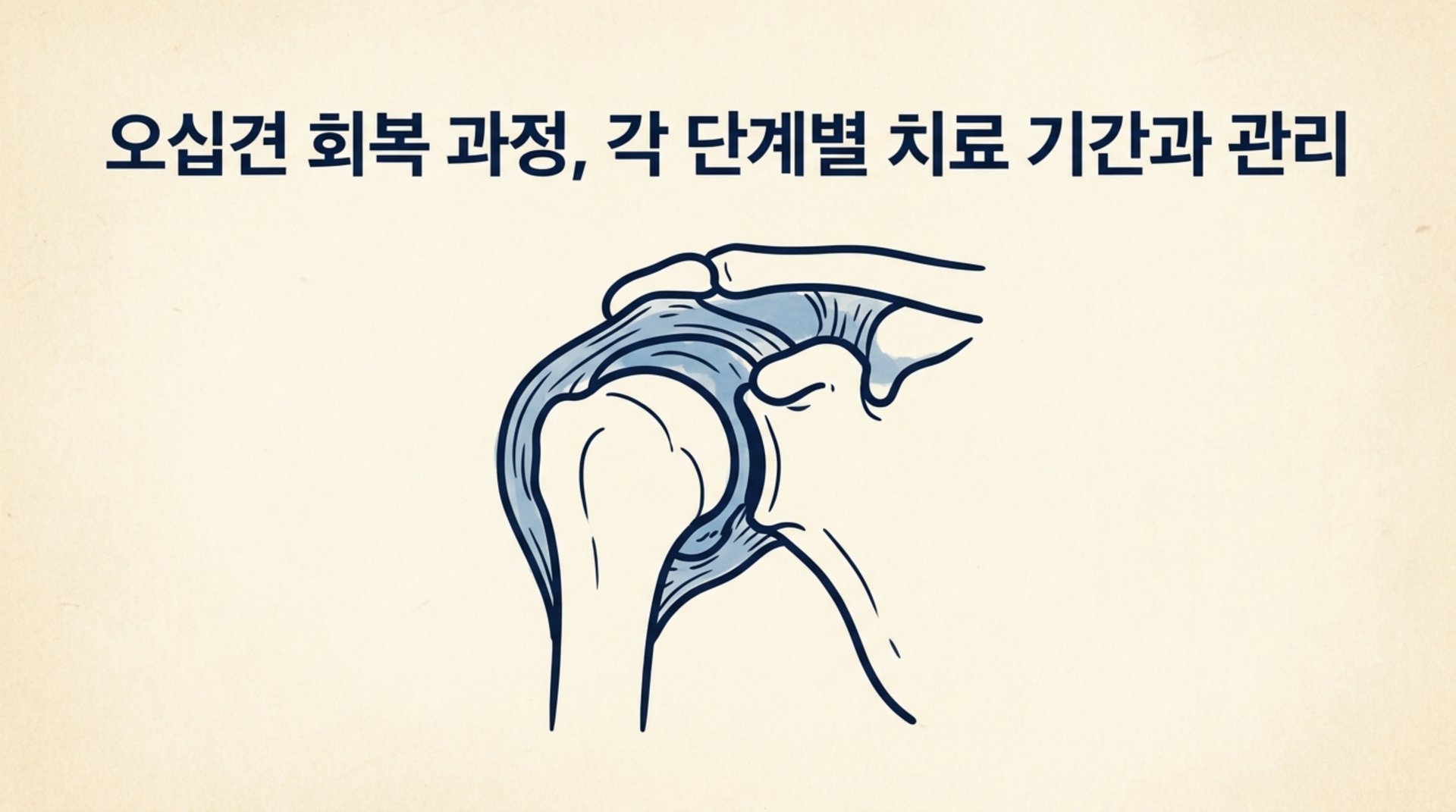 남가좌동 한의원 오십견 회복 과정, 각 단계별 치료 기간과 관리 안내 이미지