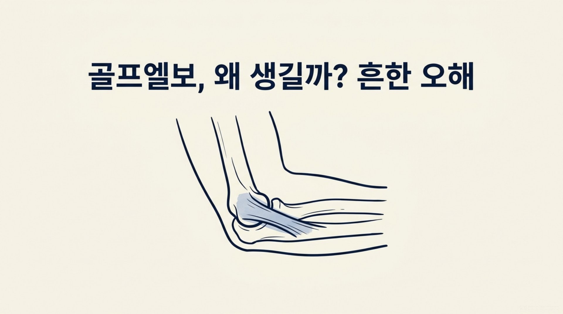남가좌동 한의원 골프엘보, 왜 생길까? 흔한 오해 안내 이미지