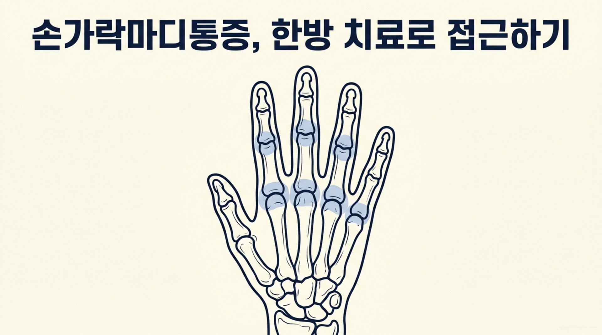 남가좌동 한의원 손가락마디통증, 한방 치료로 접근하기 안내 이미지