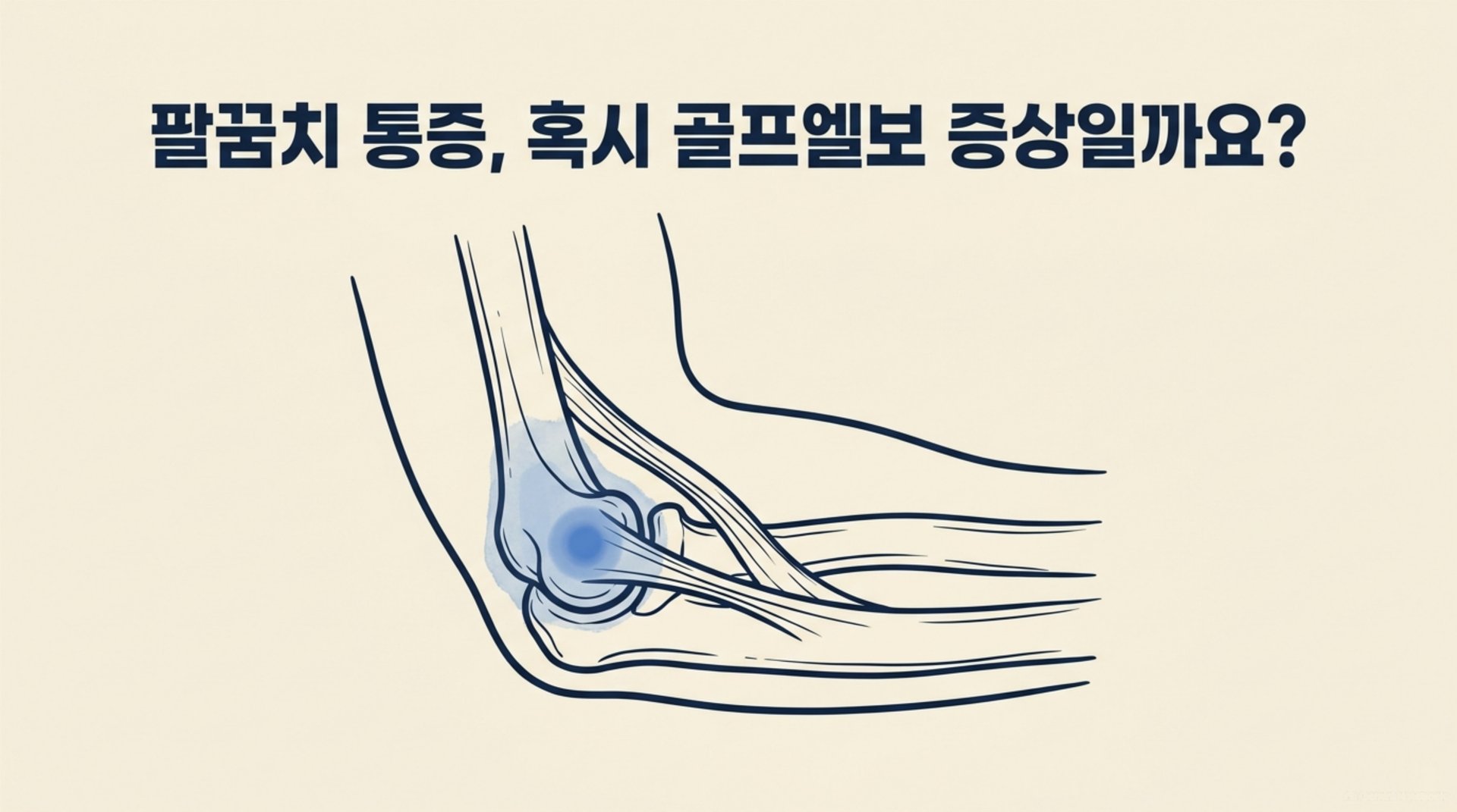 남가좌동 한의원 팔꿈치 통증, 혹시 골프엘보 증상일까요? 안내 이미지