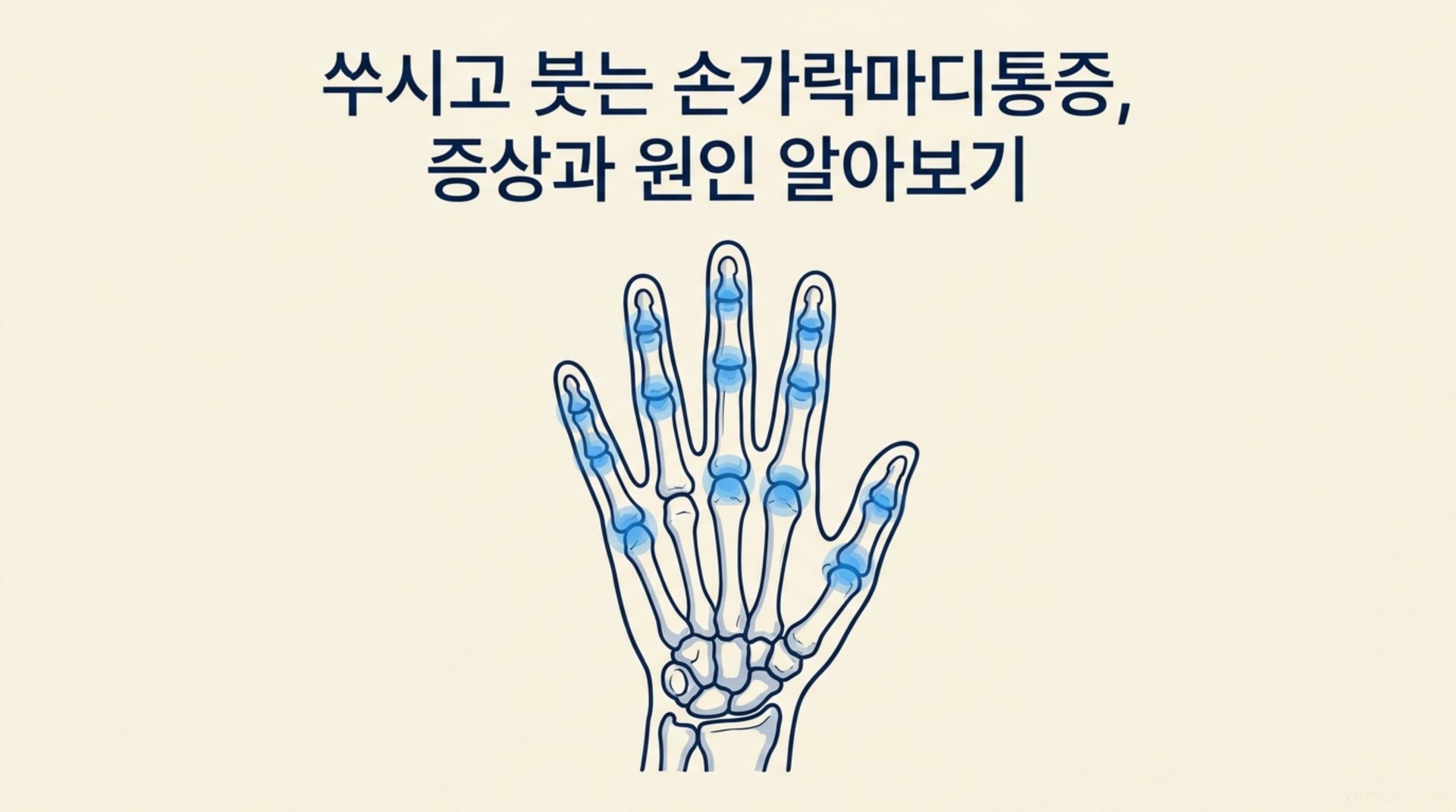 남가좌동 한의원 쑤시고 붓는 손가락마디통증, 증상과 원인 알아보기 안내 이미지
