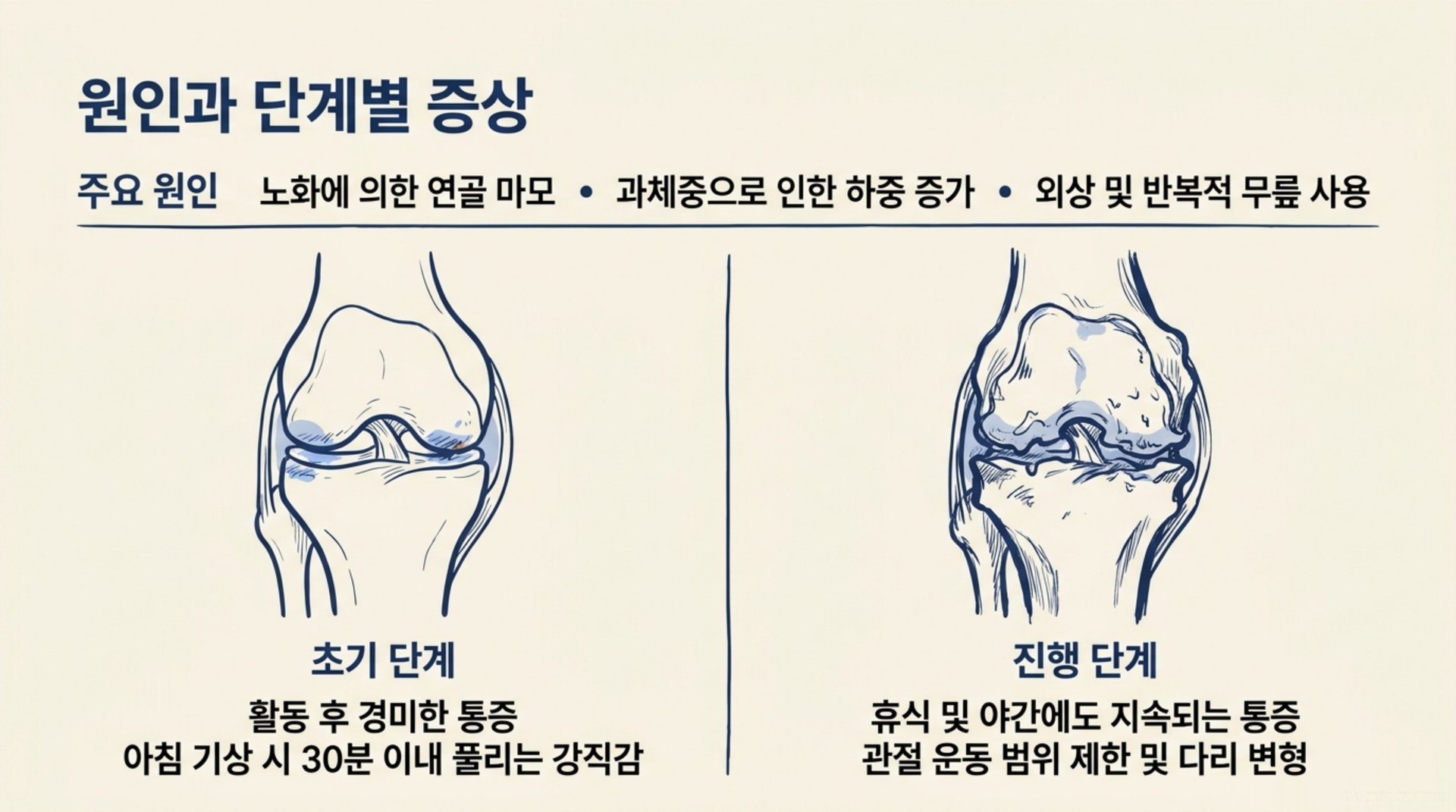 북가좌동 한의원 원인과 단계별 증상 안내 이미지