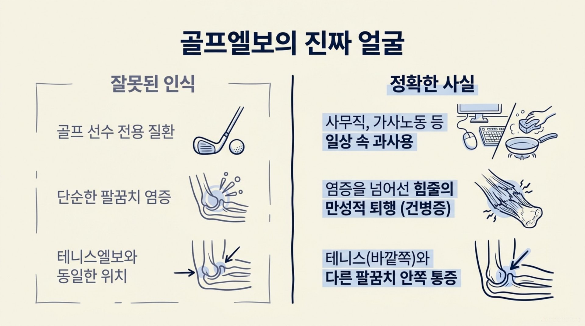 북가좌동 한의원 골프엘보의 진짜 얼굴 안내 이미지