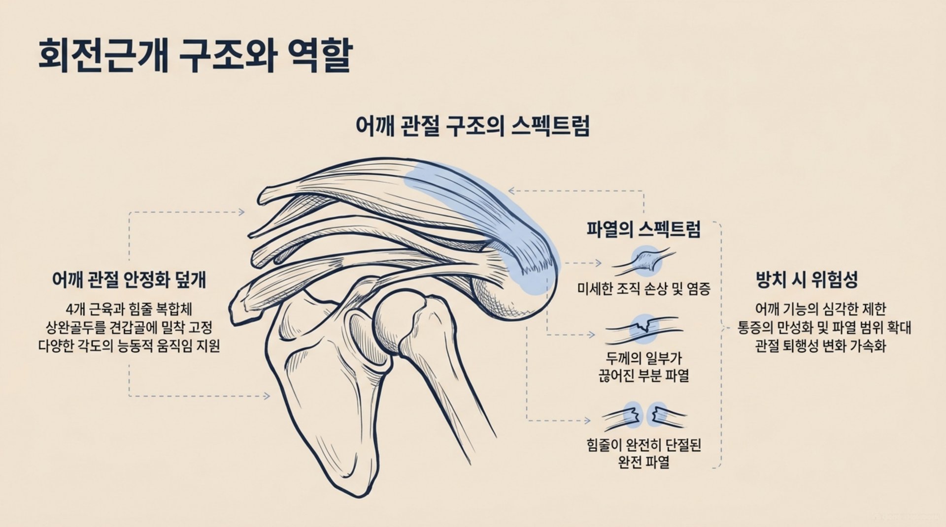 북가좌동 한의원 회전근개 구조와 역할 안내 이미지