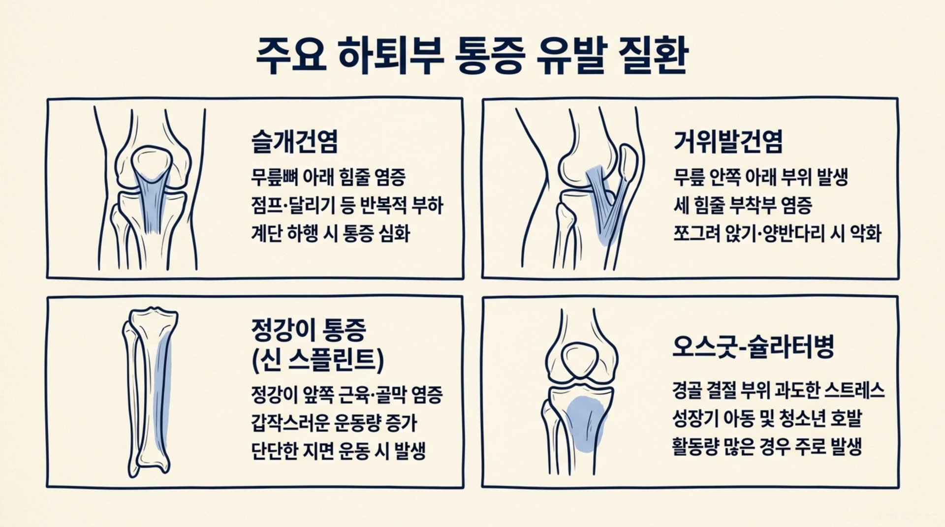 북가좌동 한의원 주요 하퇴부 통증 유발 질환 안내 이미지