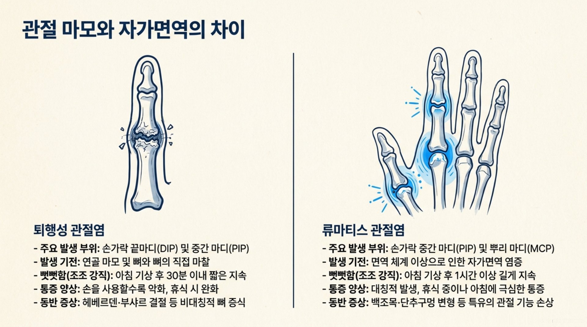 북가좌동 한의원 관절 마모와 자가면역의 차이 안내 이미지