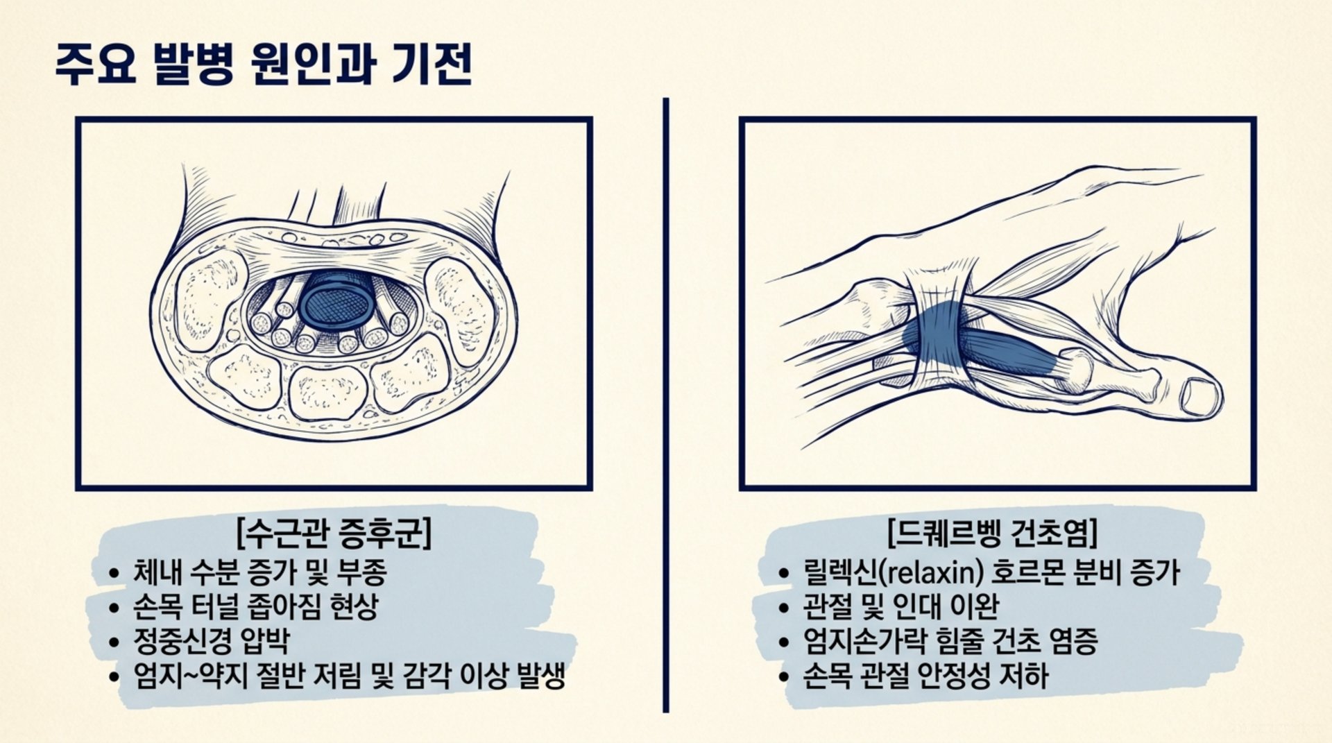북가좌동 한의원 주요 발병 원인과 기전 안내 이미지