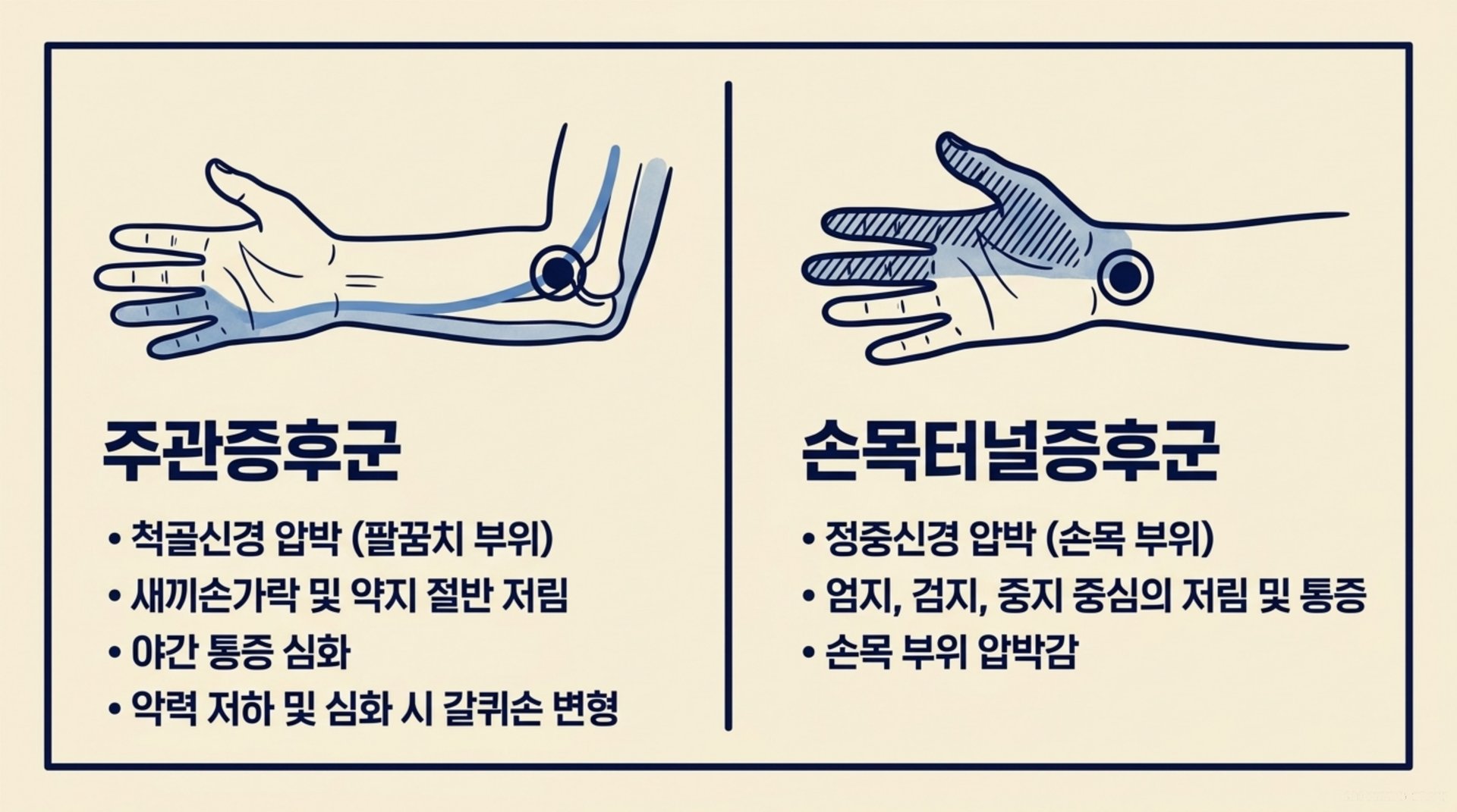 서대문구 한의원 주관증후군과 손목터널증후군 감별 안내 이미지