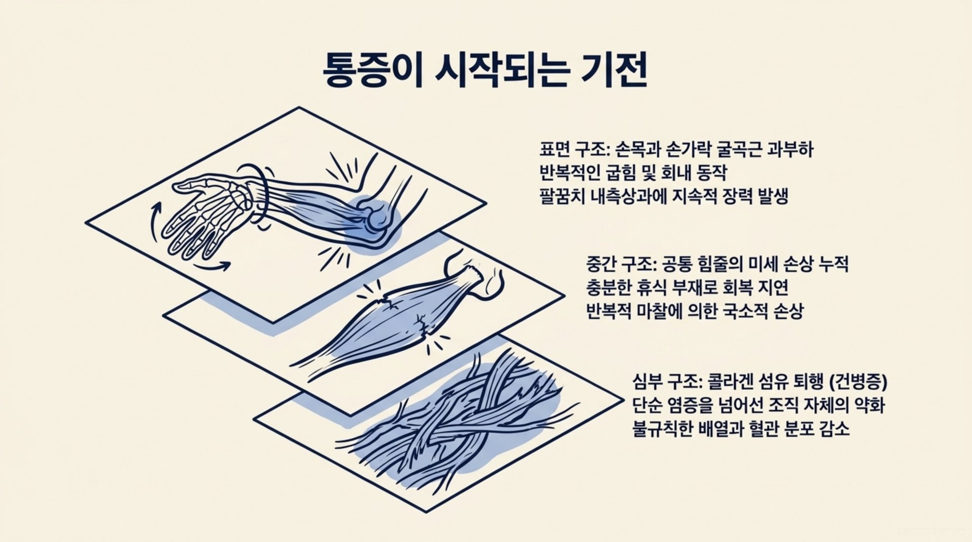 서대문구 한의원 통증이 시작되는 기전 안내 이미지
