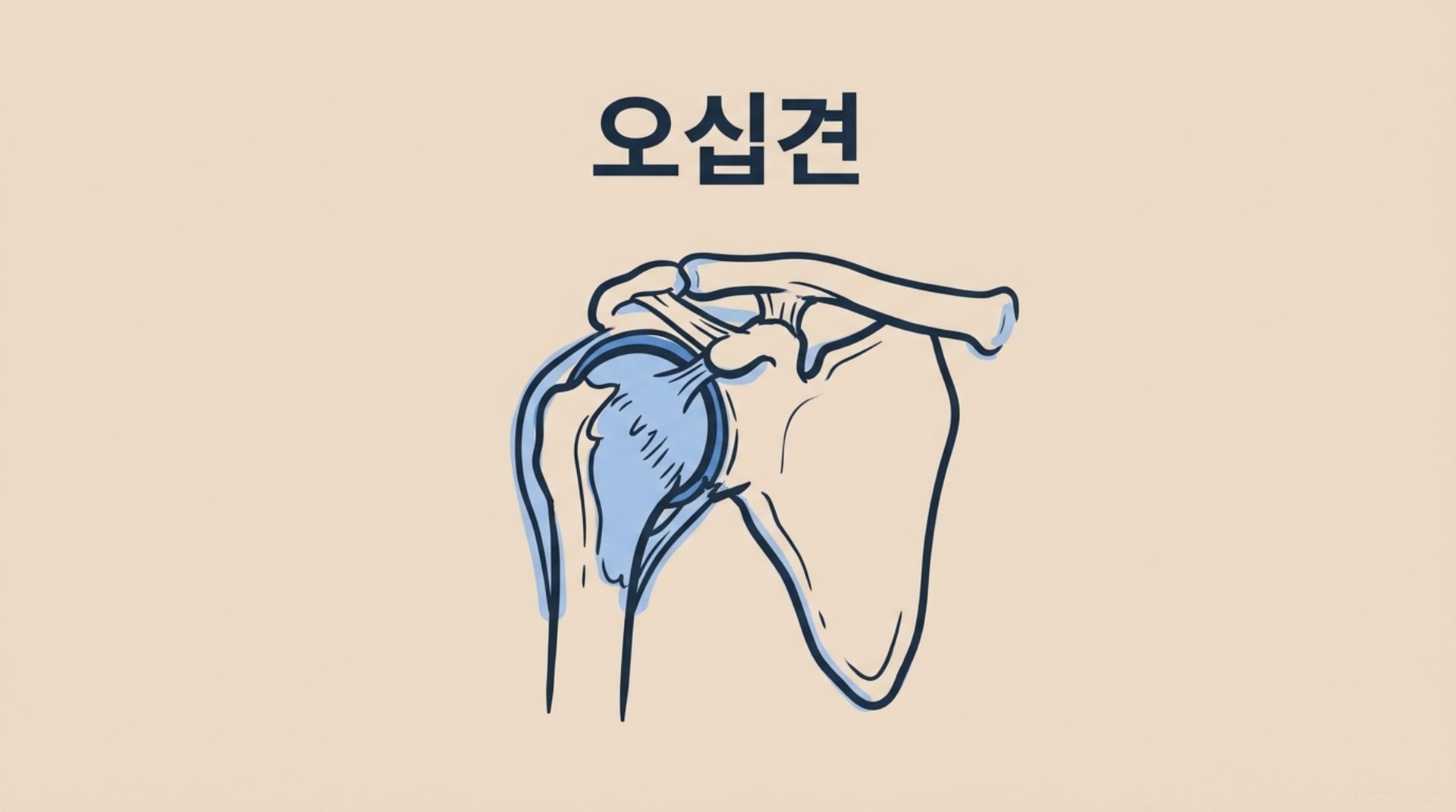남가좌동 한의원 오십견 안내 이미지