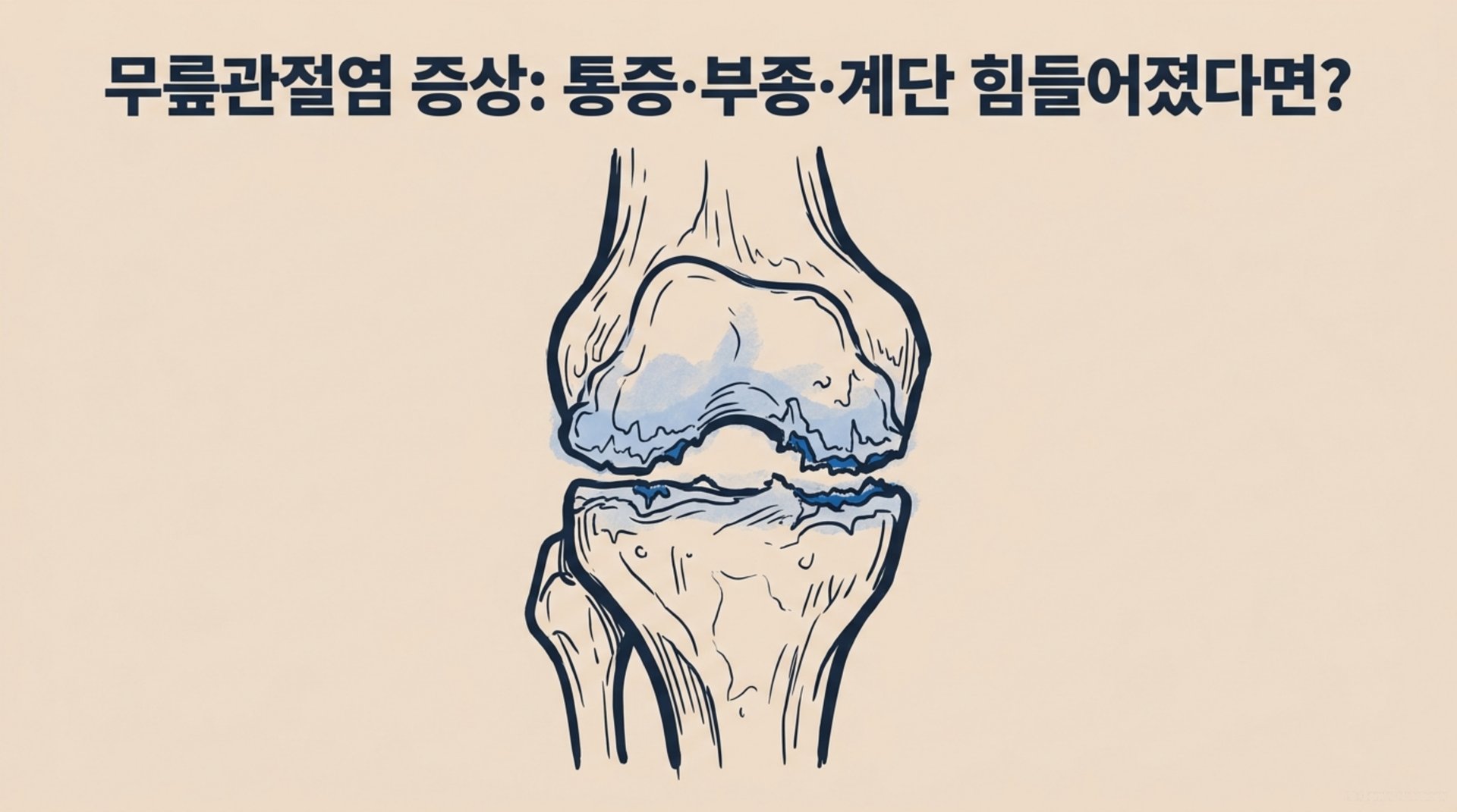 남가좌동 한의원 무릎관절염 증상: 통증·부종·계단 힘들어졌다면? 안내 이미지