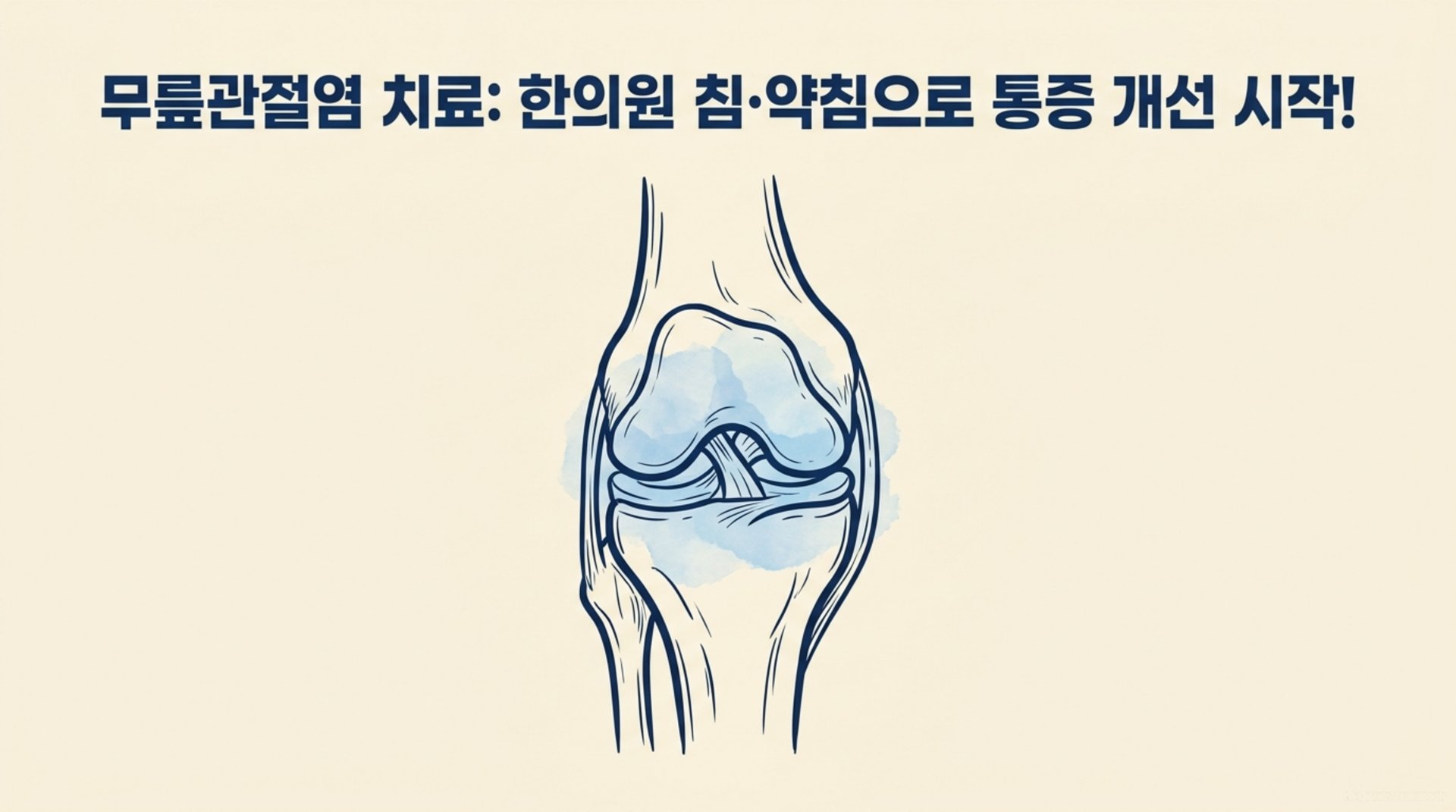 남가좌동 한의원 무릎관절염 치료: 한의원 침·약침으로 통증 개선 시작! 안내 이미지