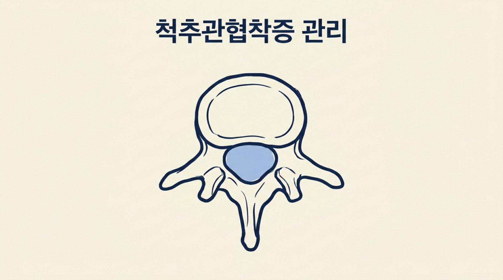 남가좌동 한의원 척추관협착증 관리 안내 이미지
