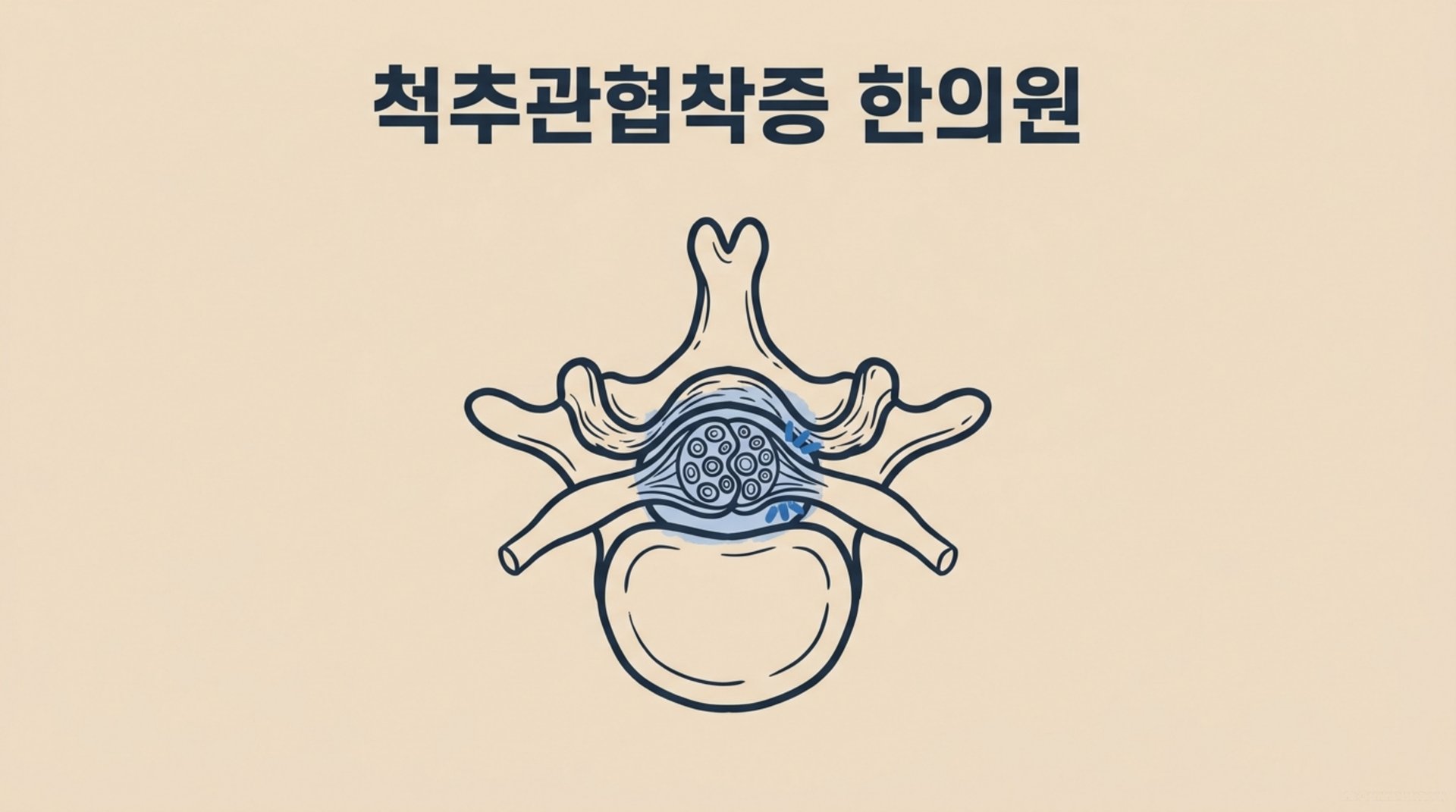 남가좌동 한의원 척추관협착증 한의원 안내 이미지