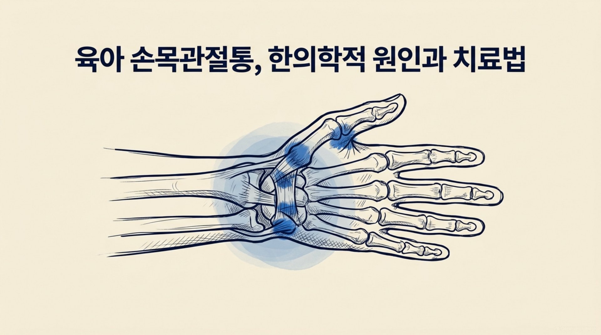남가좌동 한의원 육아 손목관절통, 한의학적 원인과 치료법 안내 이미지