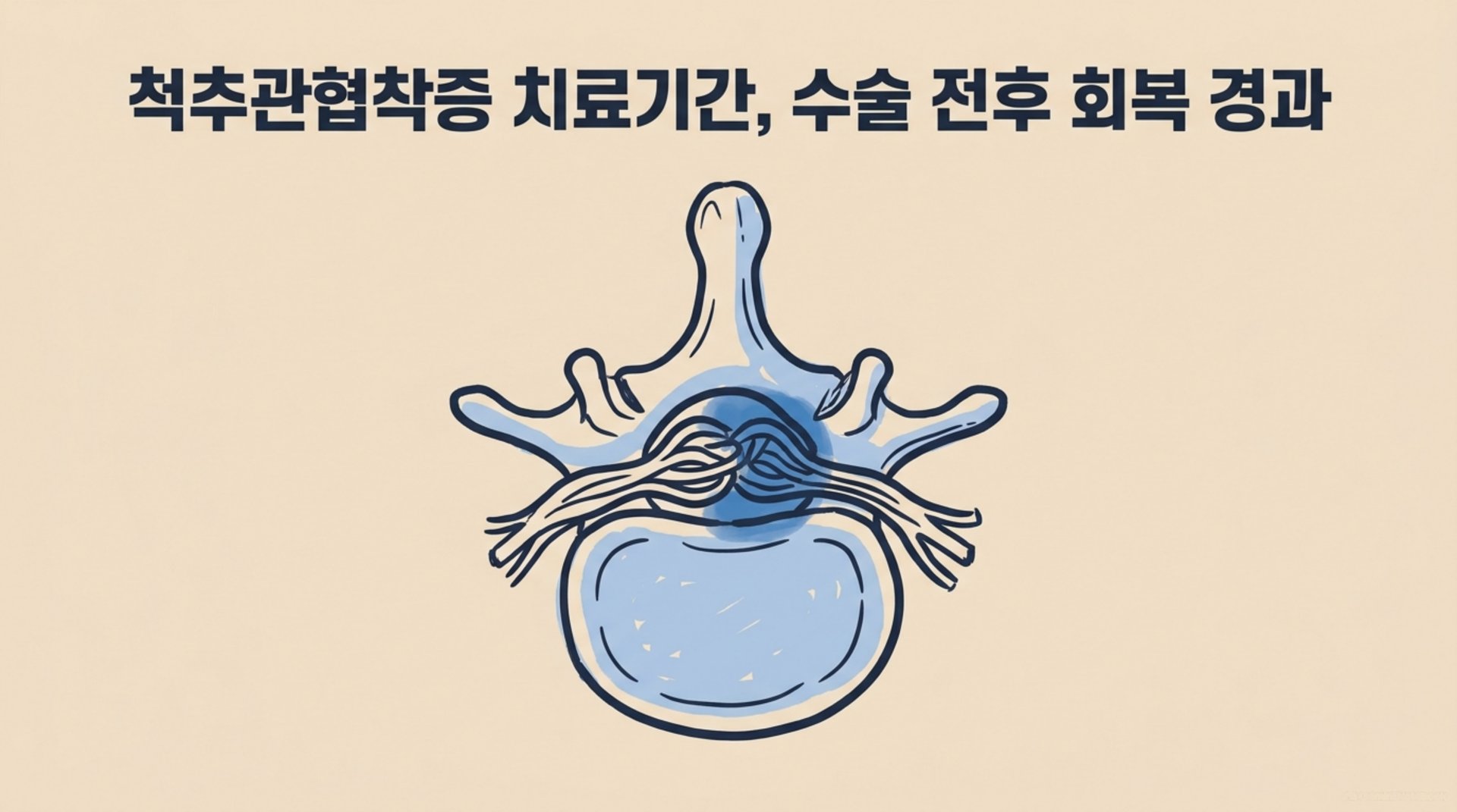 남가좌동 한의원 척추관협착증 치료기간, 수술 전후 회복 경과 안내 이미지
