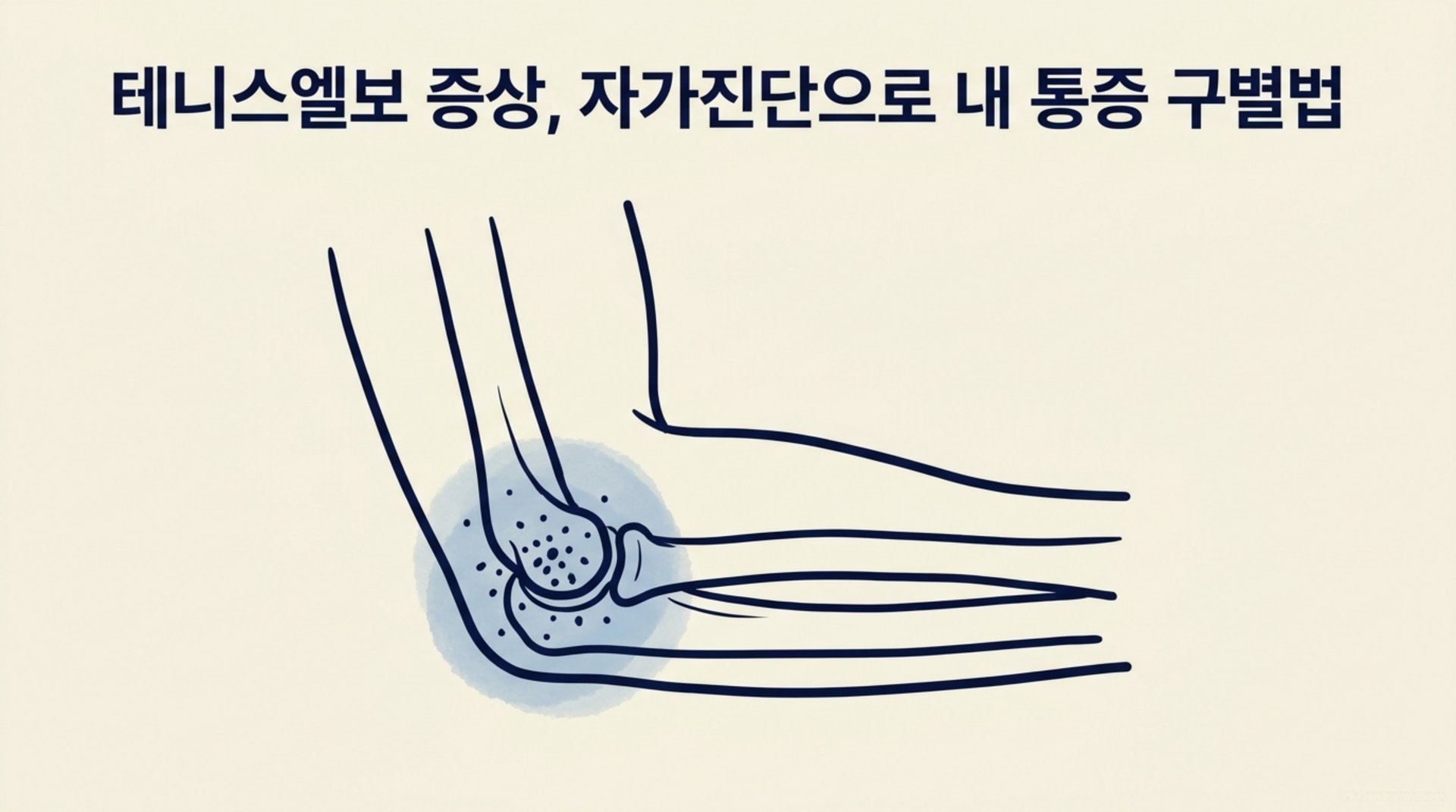 남가좌동 한의원 테니스엘보 증상, 자가진단으로 내 통증 구별법 안내 이미지